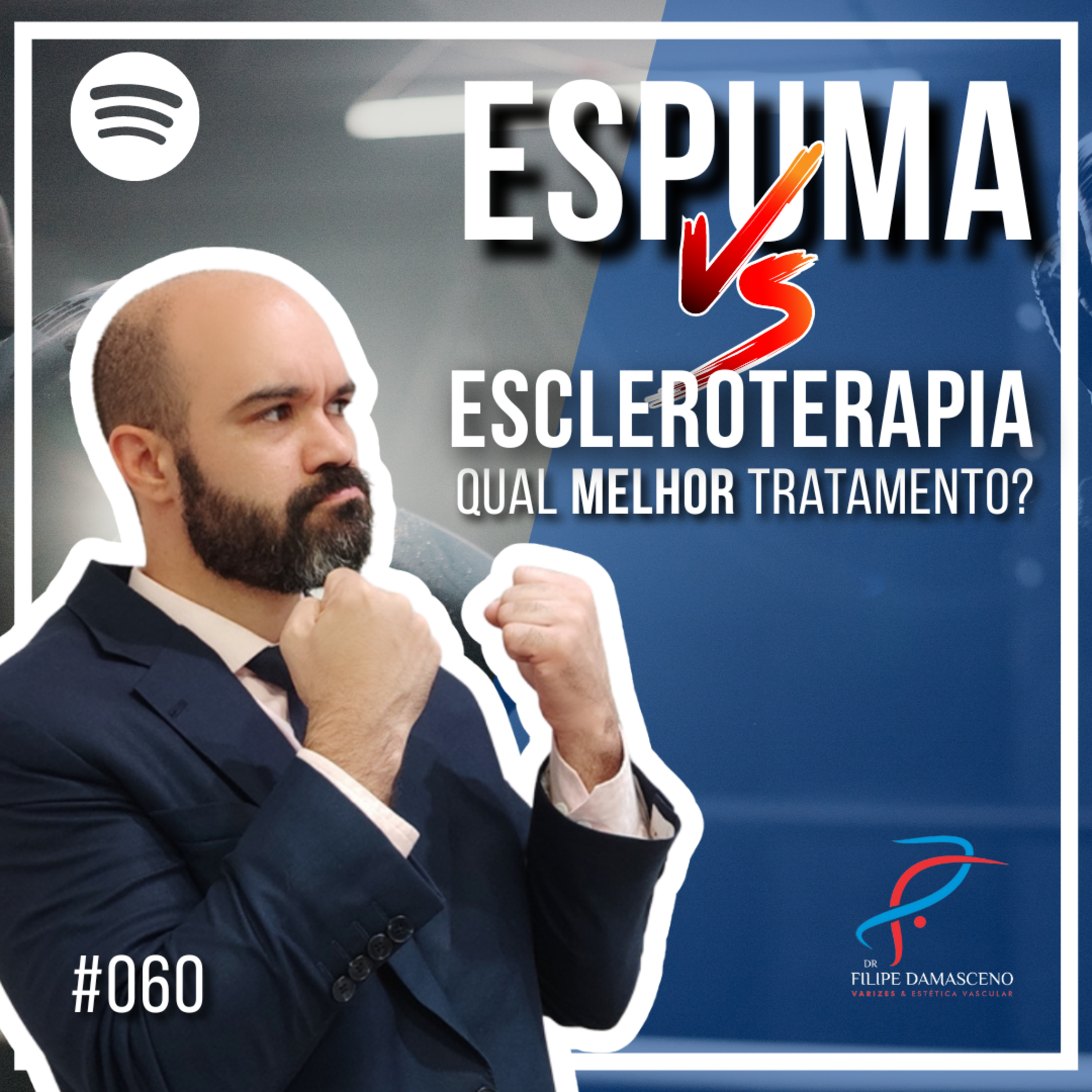 Filipe Damasceno | Vida sem Varizes