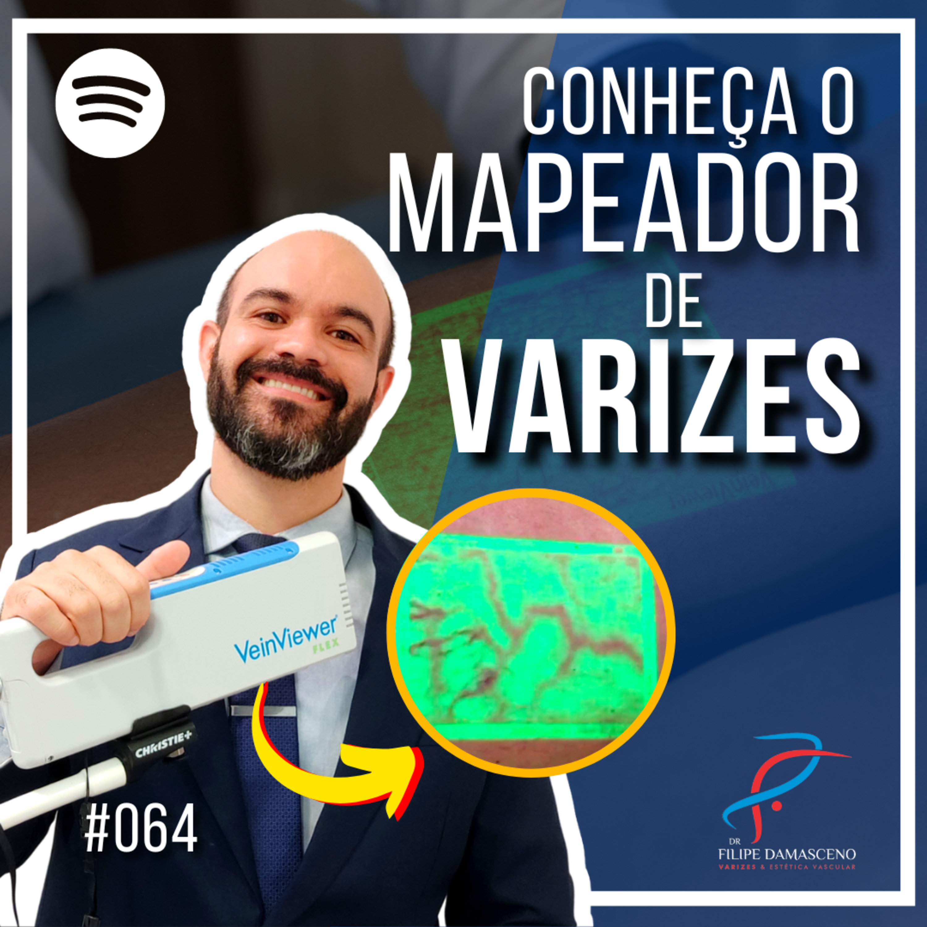 Filipe Damasceno | Vida sem Varizes