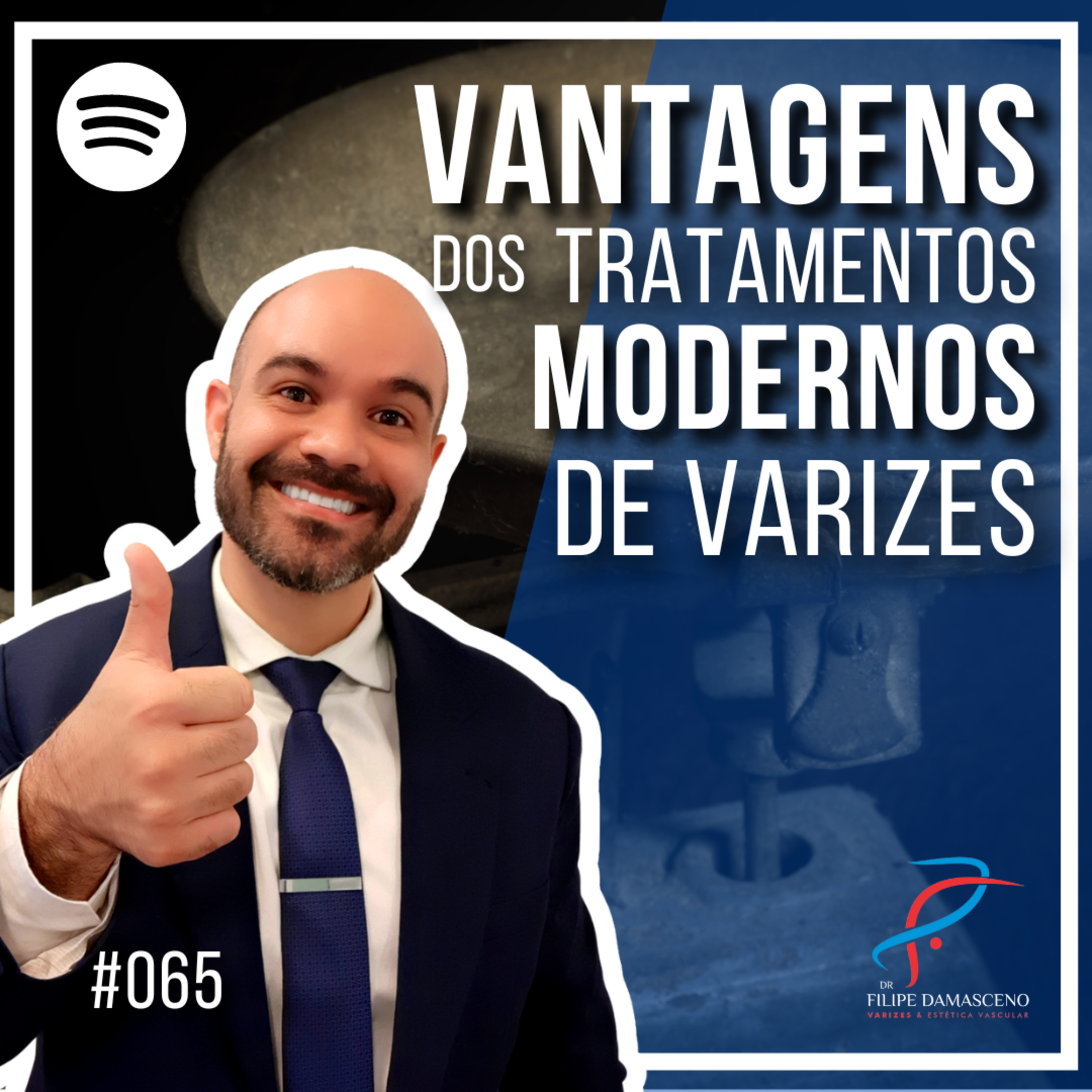 Filipe Damasceno | Vida sem Varizes