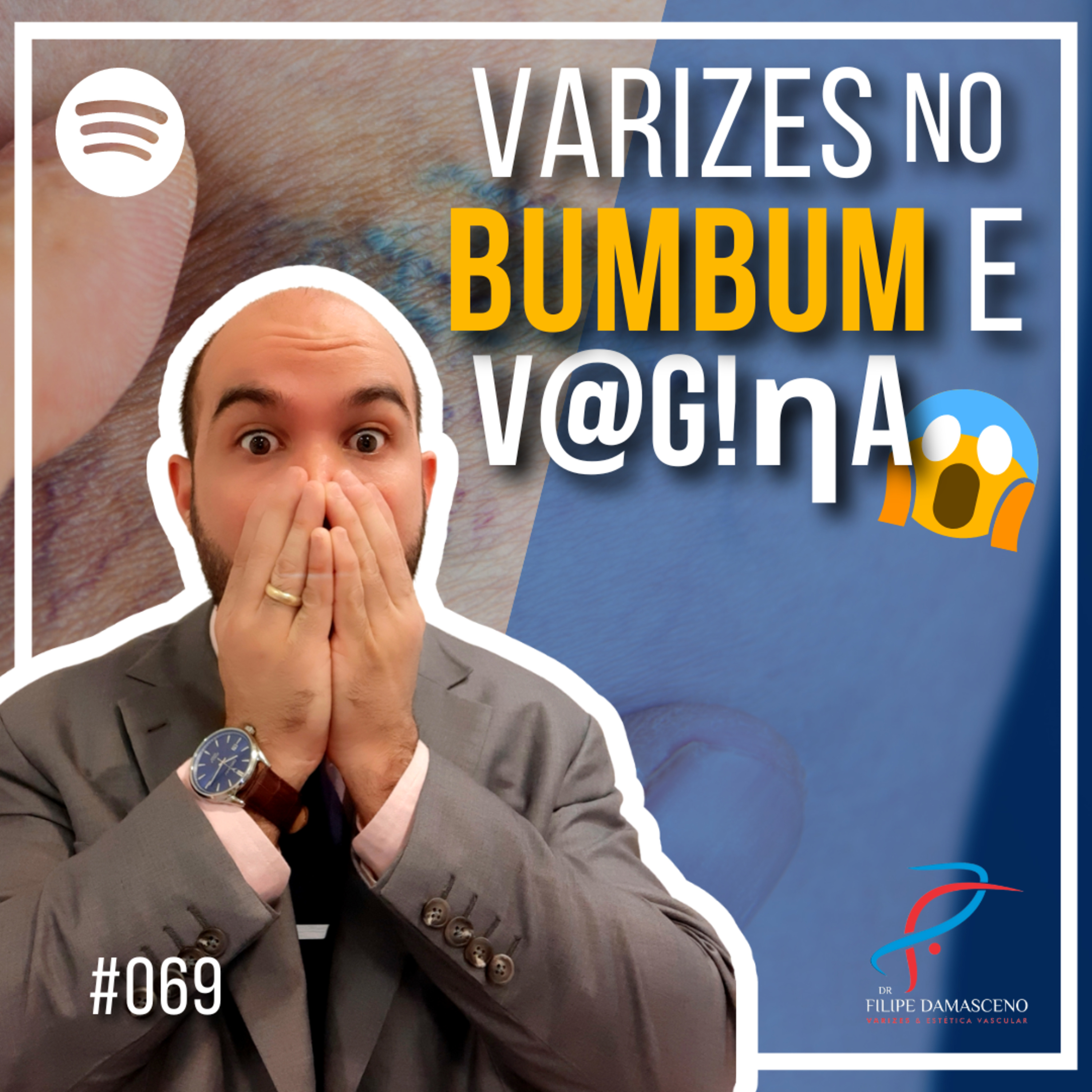 Filipe Damasceno | Vida sem Varizes