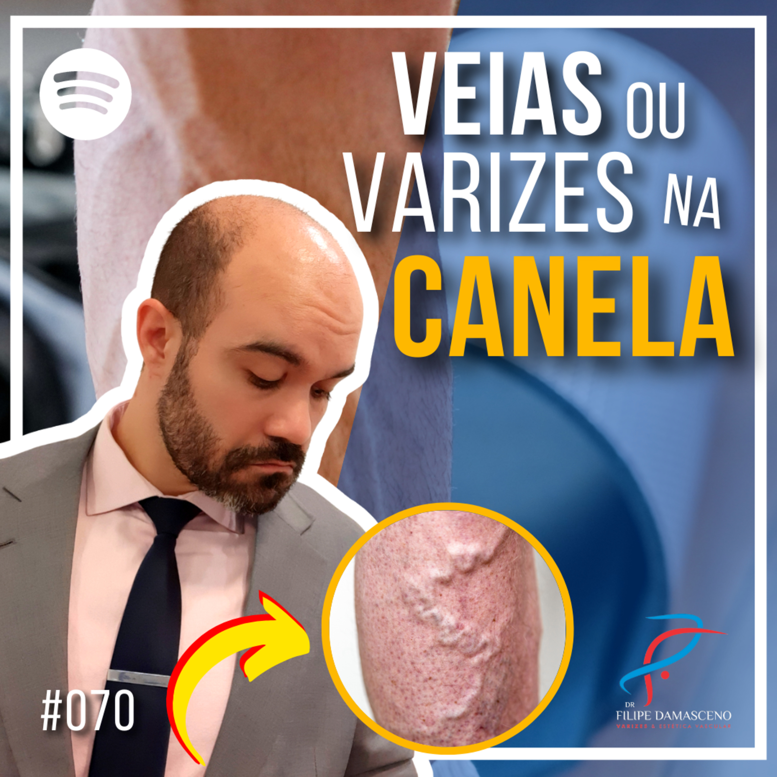 Filipe Damasceno | Vida sem Varizes