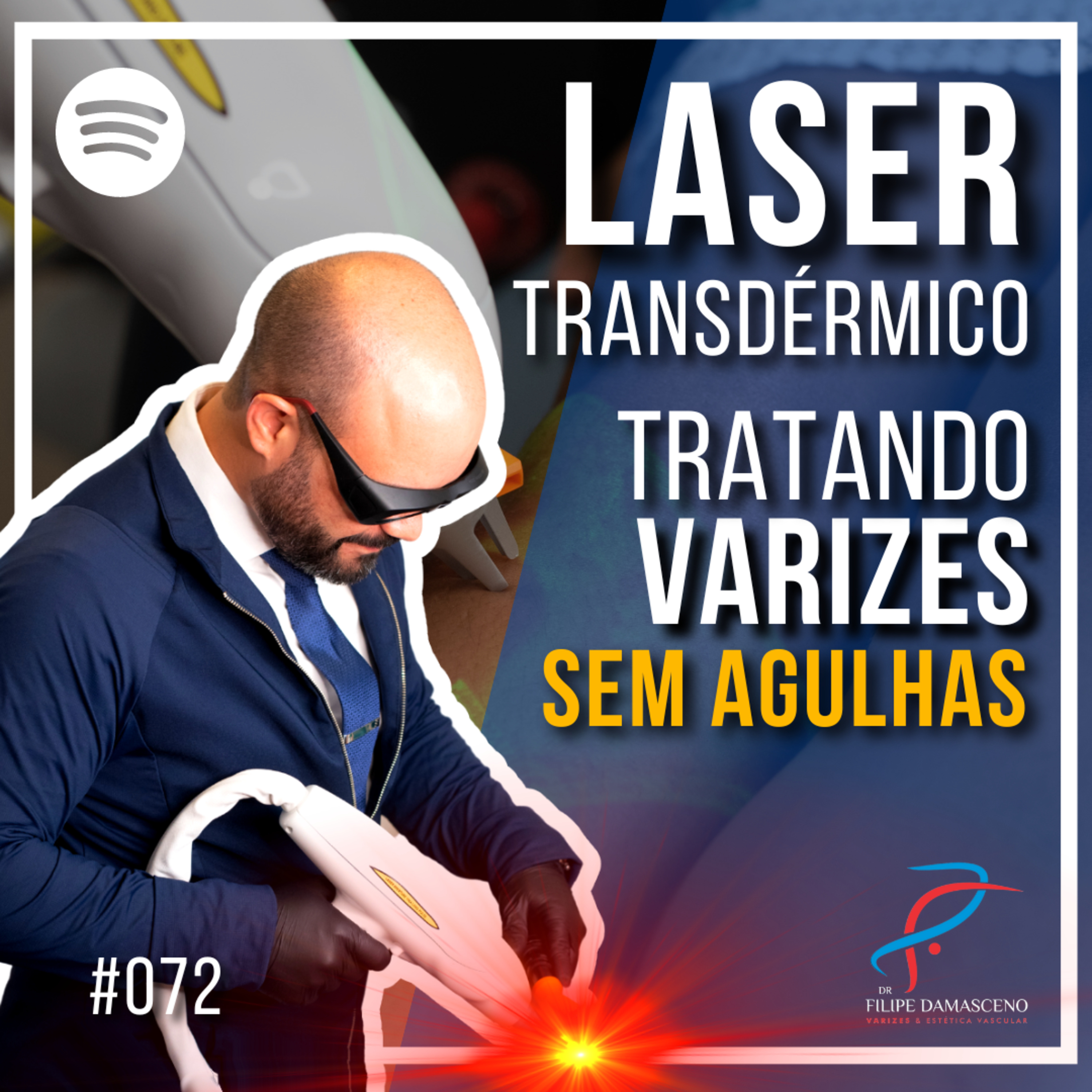 Filipe Damasceno | Vida sem Varizes