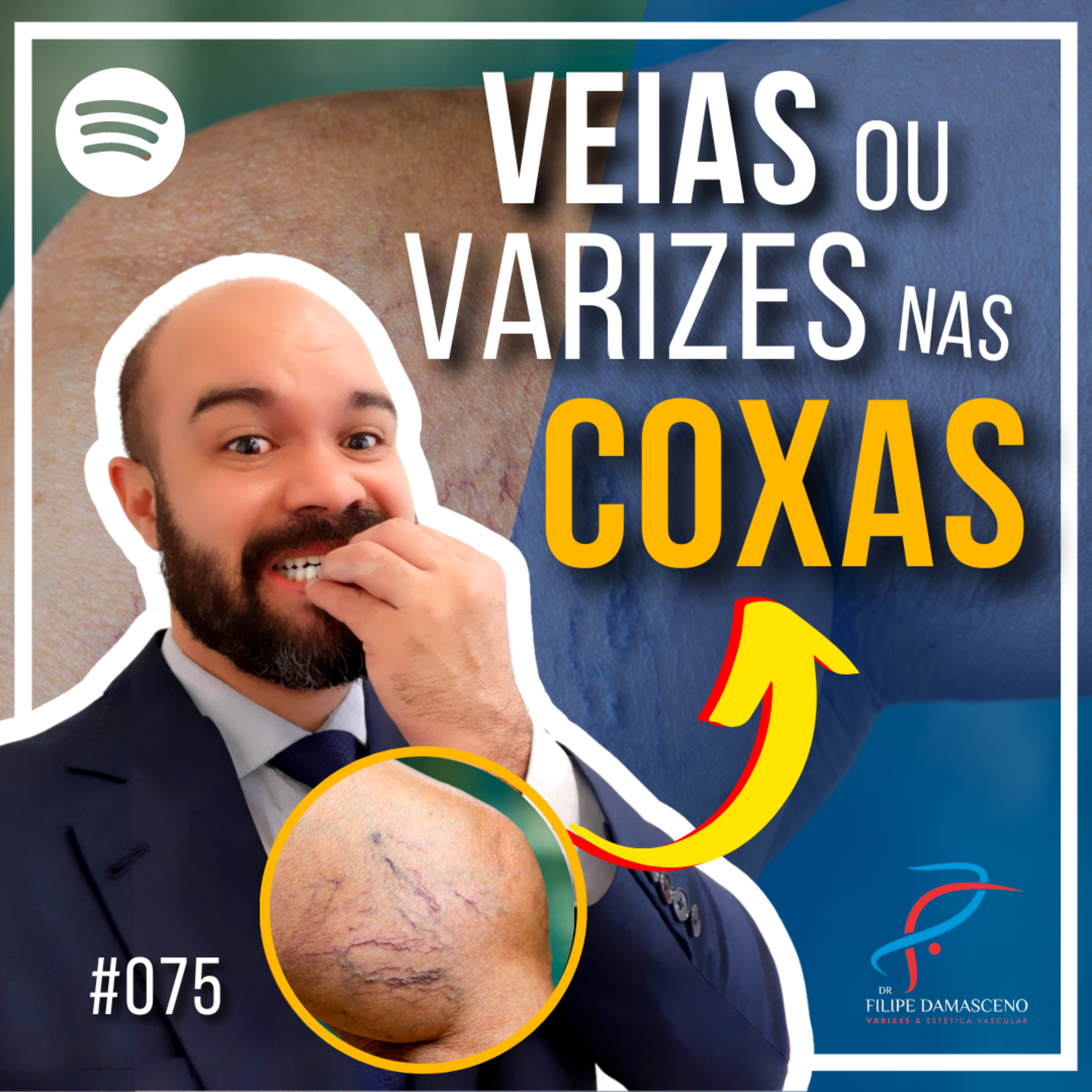 Filipe Damasceno | Vida sem Varizes