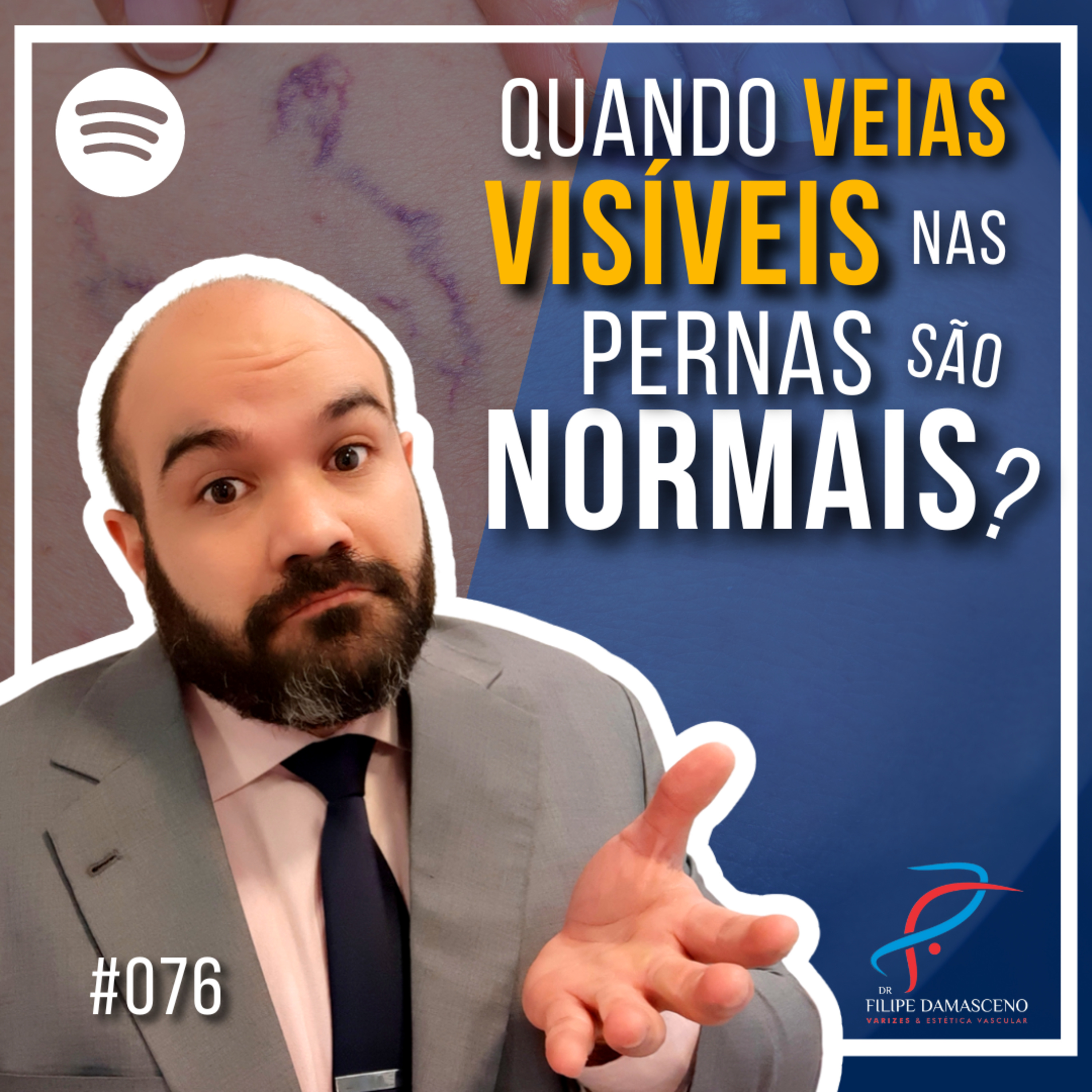Filipe Damasceno | Vida sem Varizes