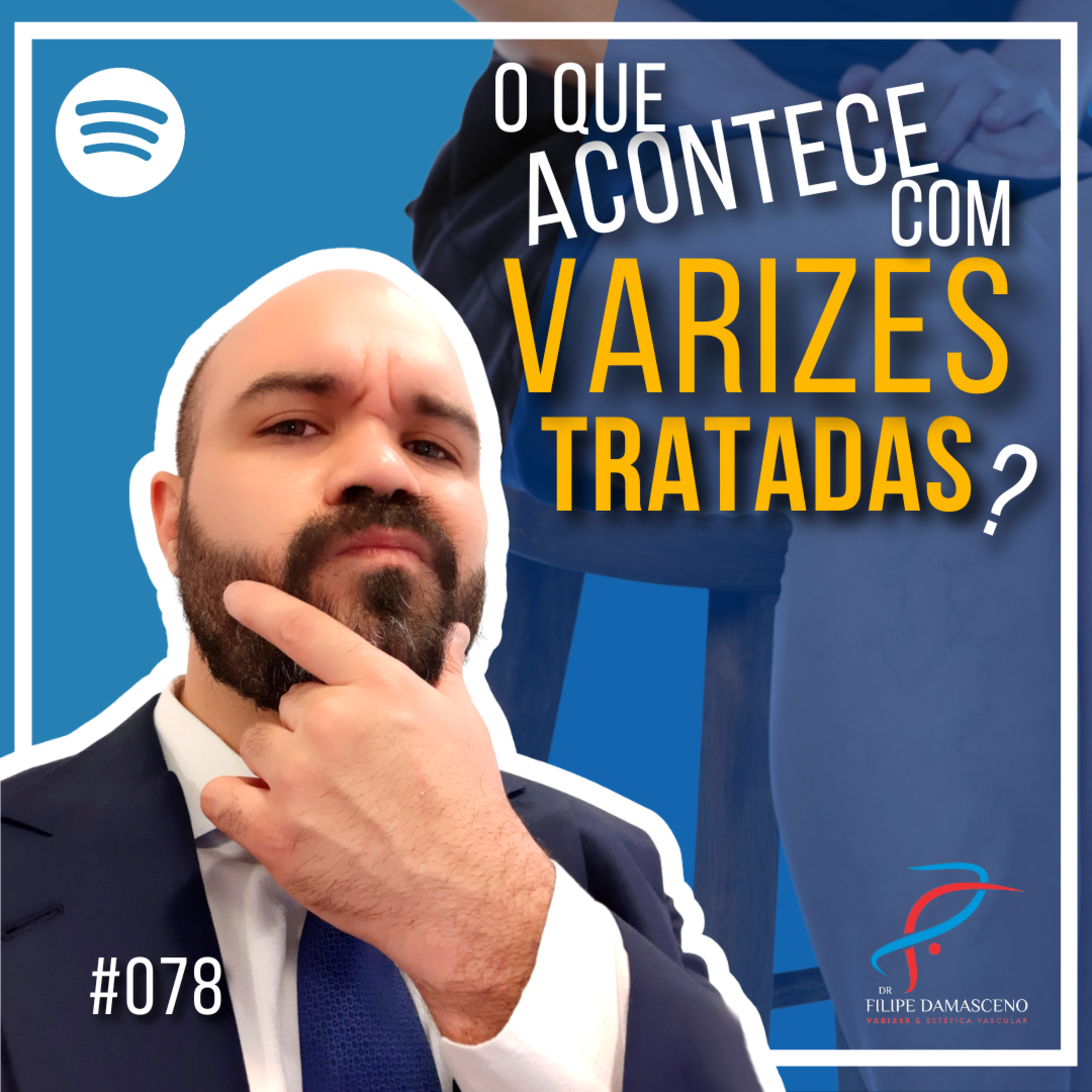 Filipe Damasceno | Vida sem Varizes