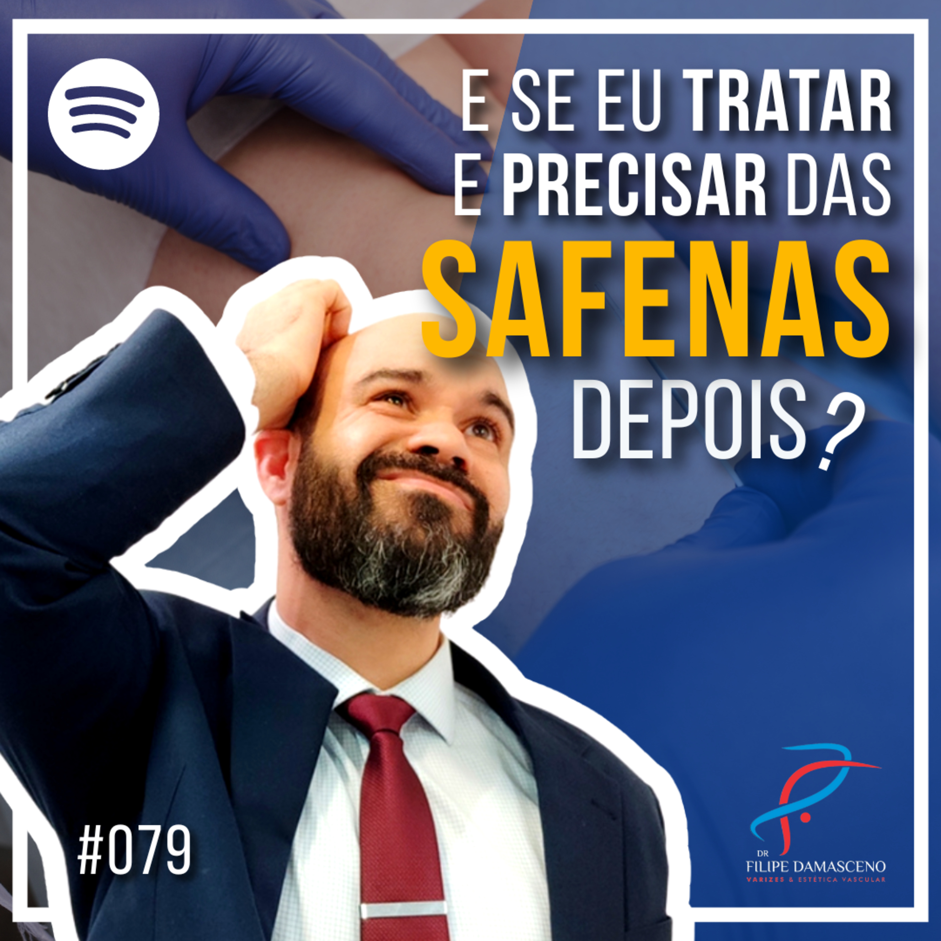 Filipe Damasceno | Vida sem Varizes