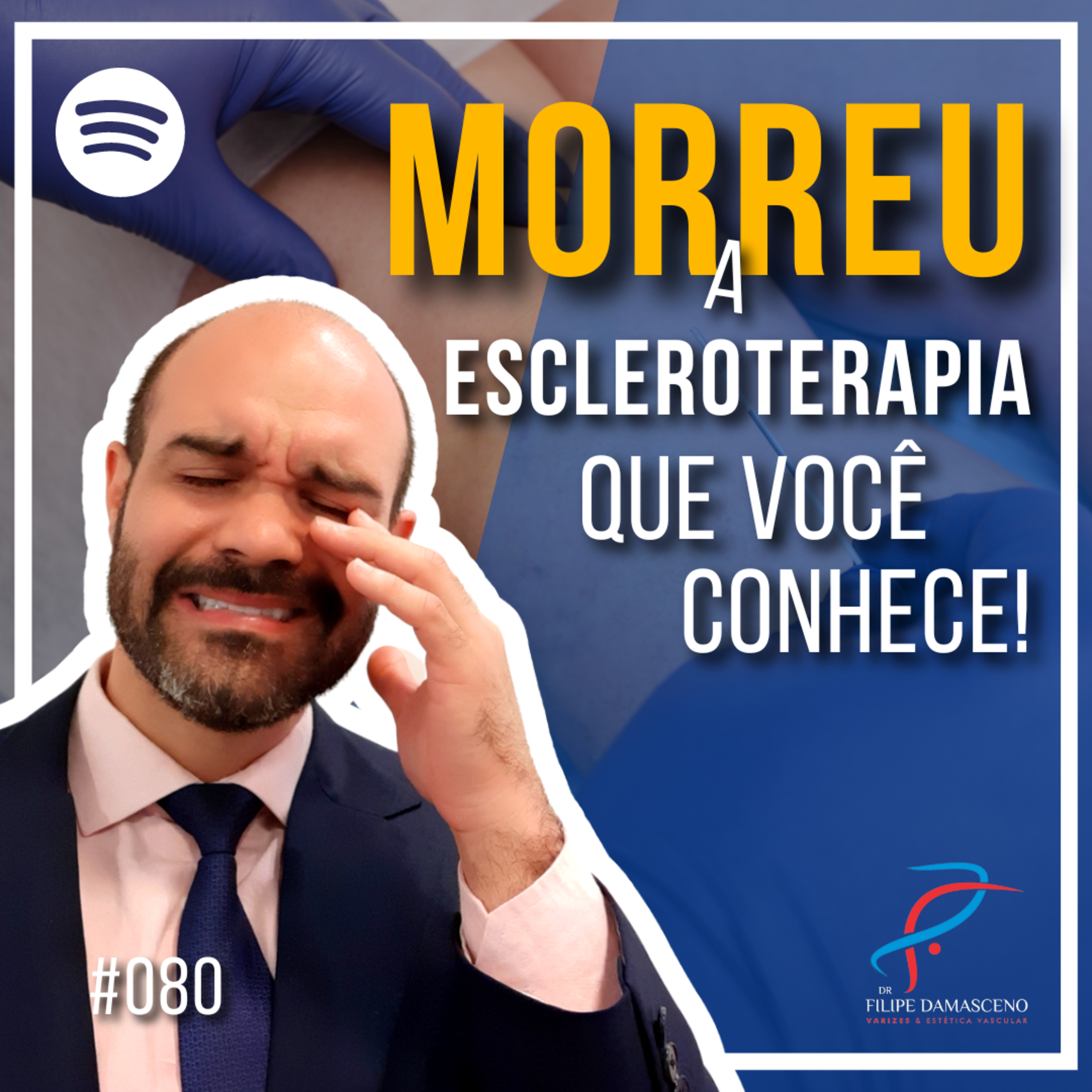 Filipe Damasceno | Vida sem Varizes