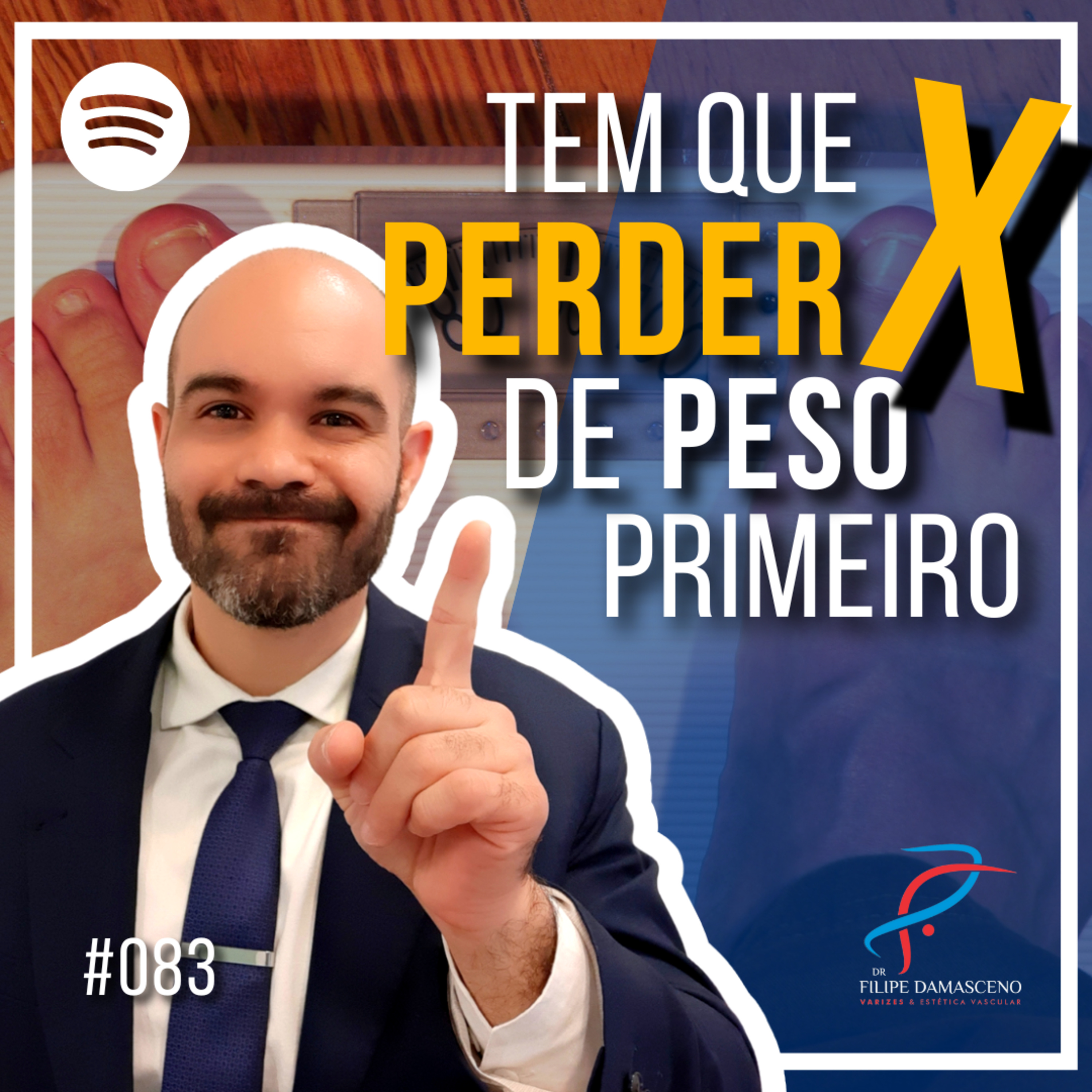 Filipe Damasceno | Vida sem Varizes
