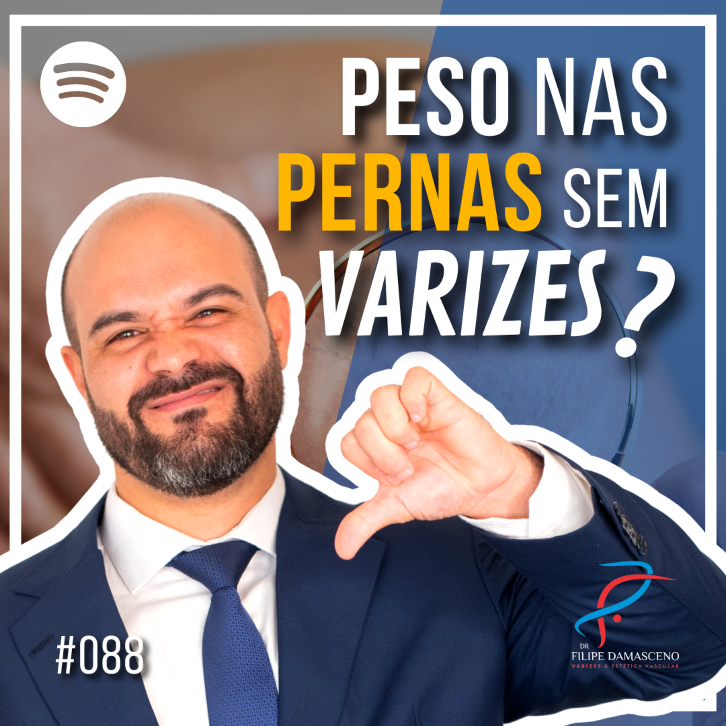Filipe Damasceno | Vida sem Varizes