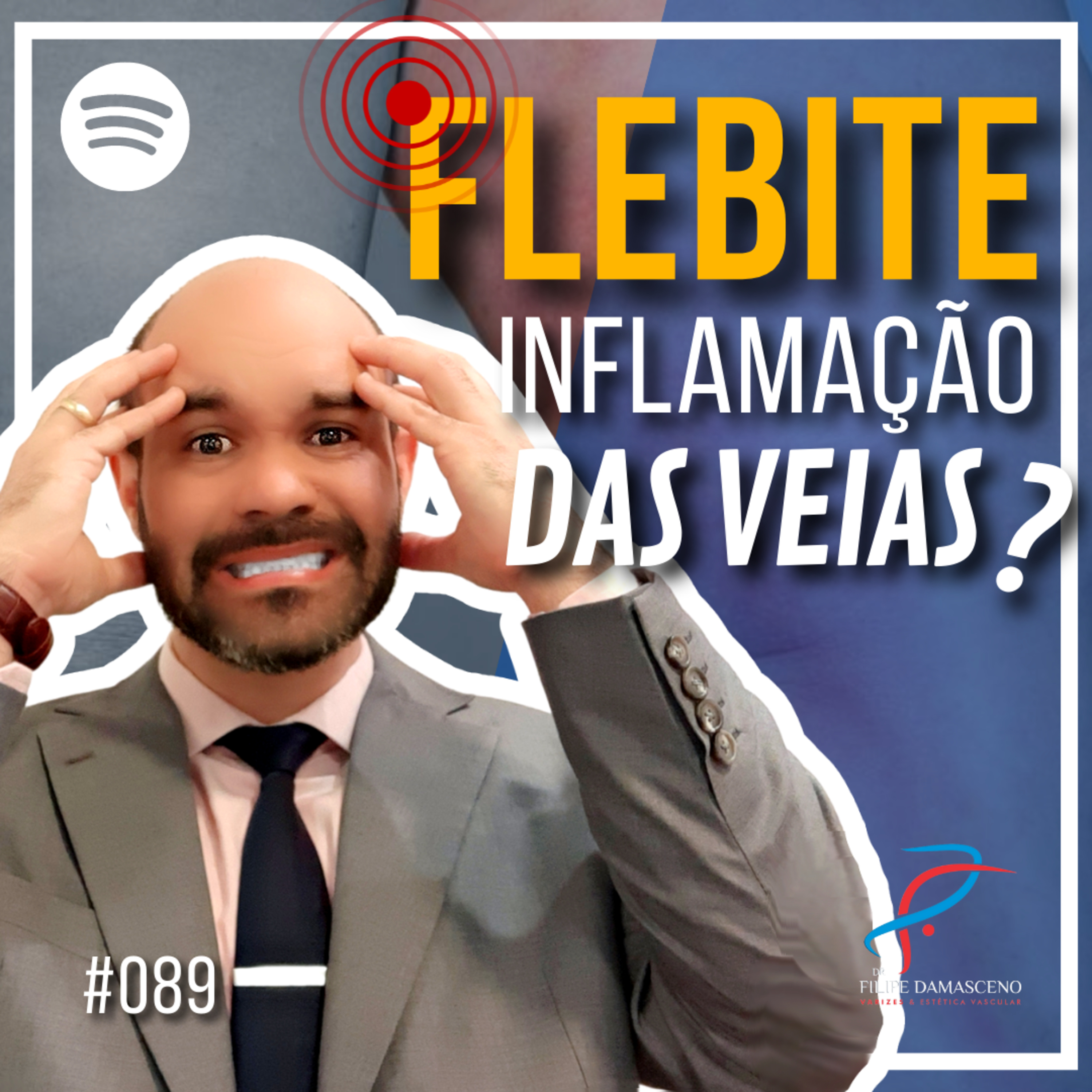 Filipe Damasceno | Vida sem Varizes