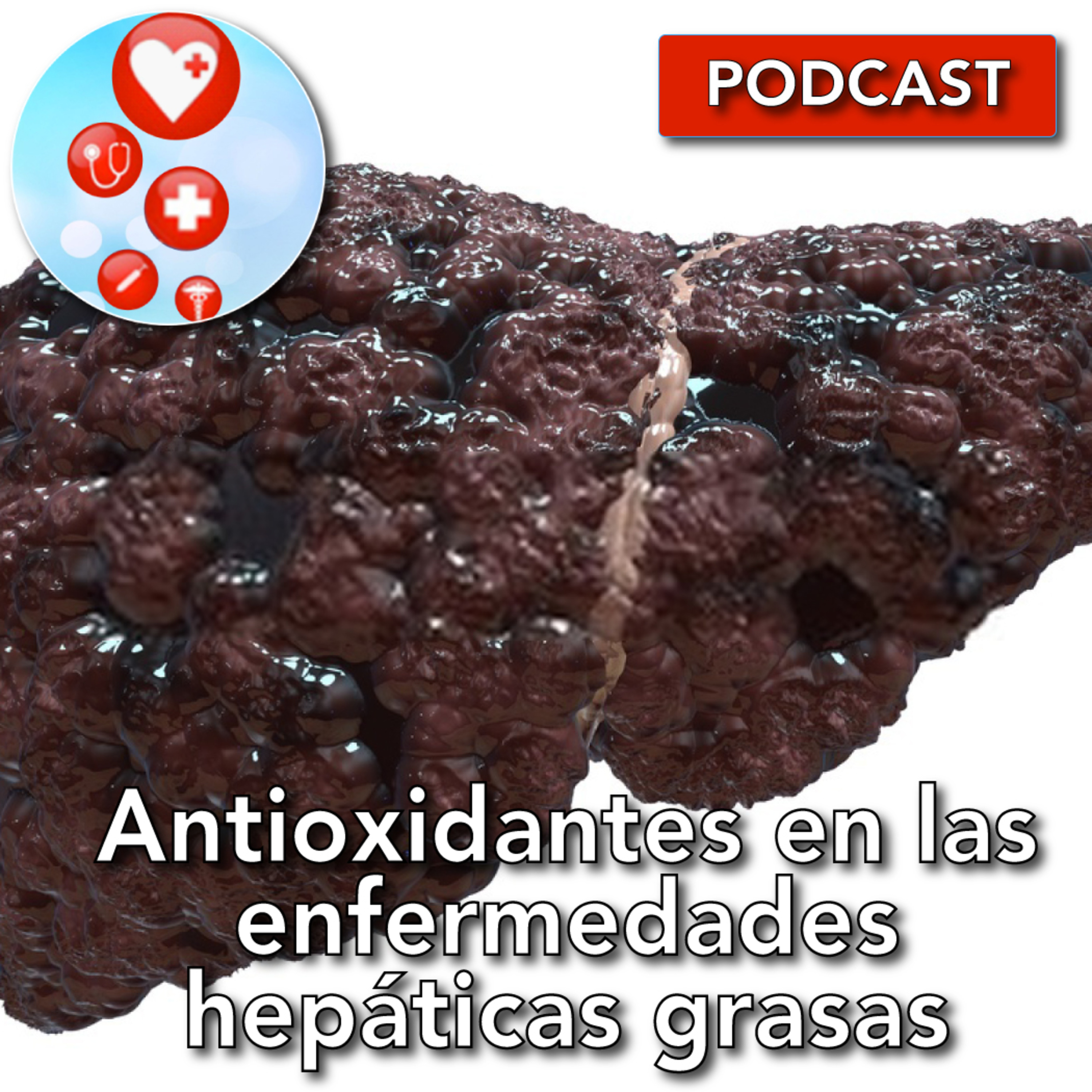 El rol del estrés oxidativo en la enfermedad hepática grasa. episode artwork