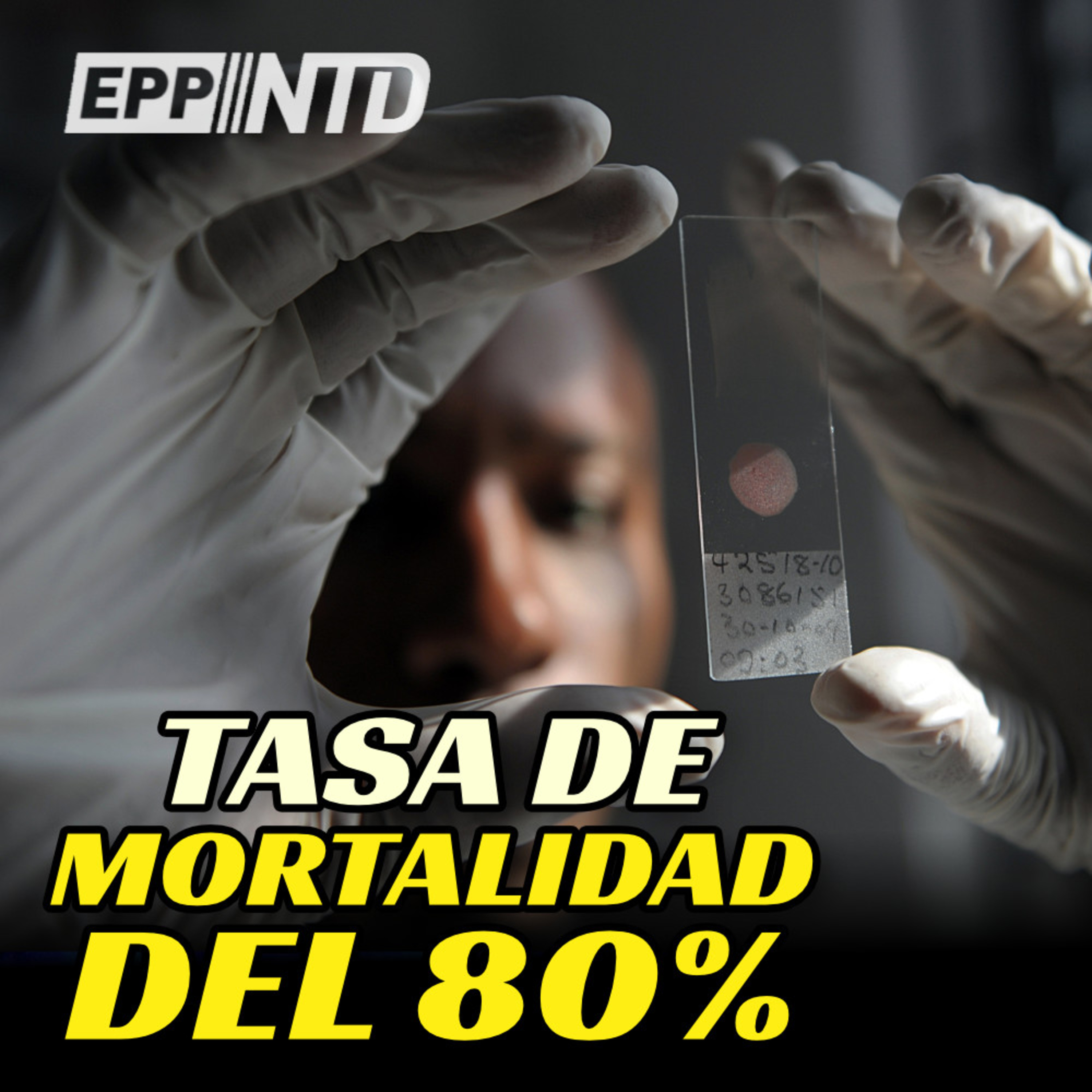 Desarrollan una cepa COVID con una tasa de mortalidad del 80% | ¿El fin del dominio occidental? episode artwork