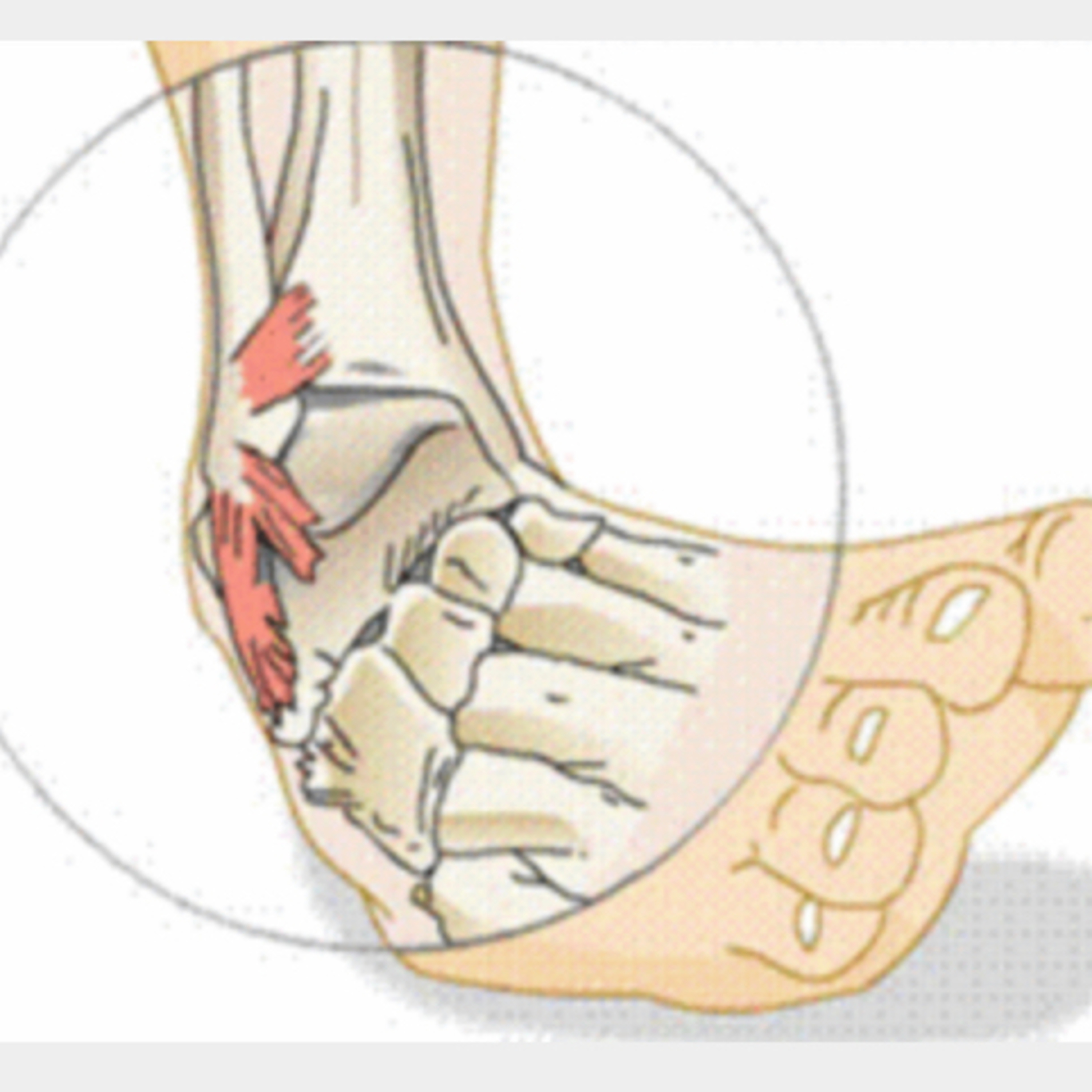 Luke Nelson: Ankle Sprains