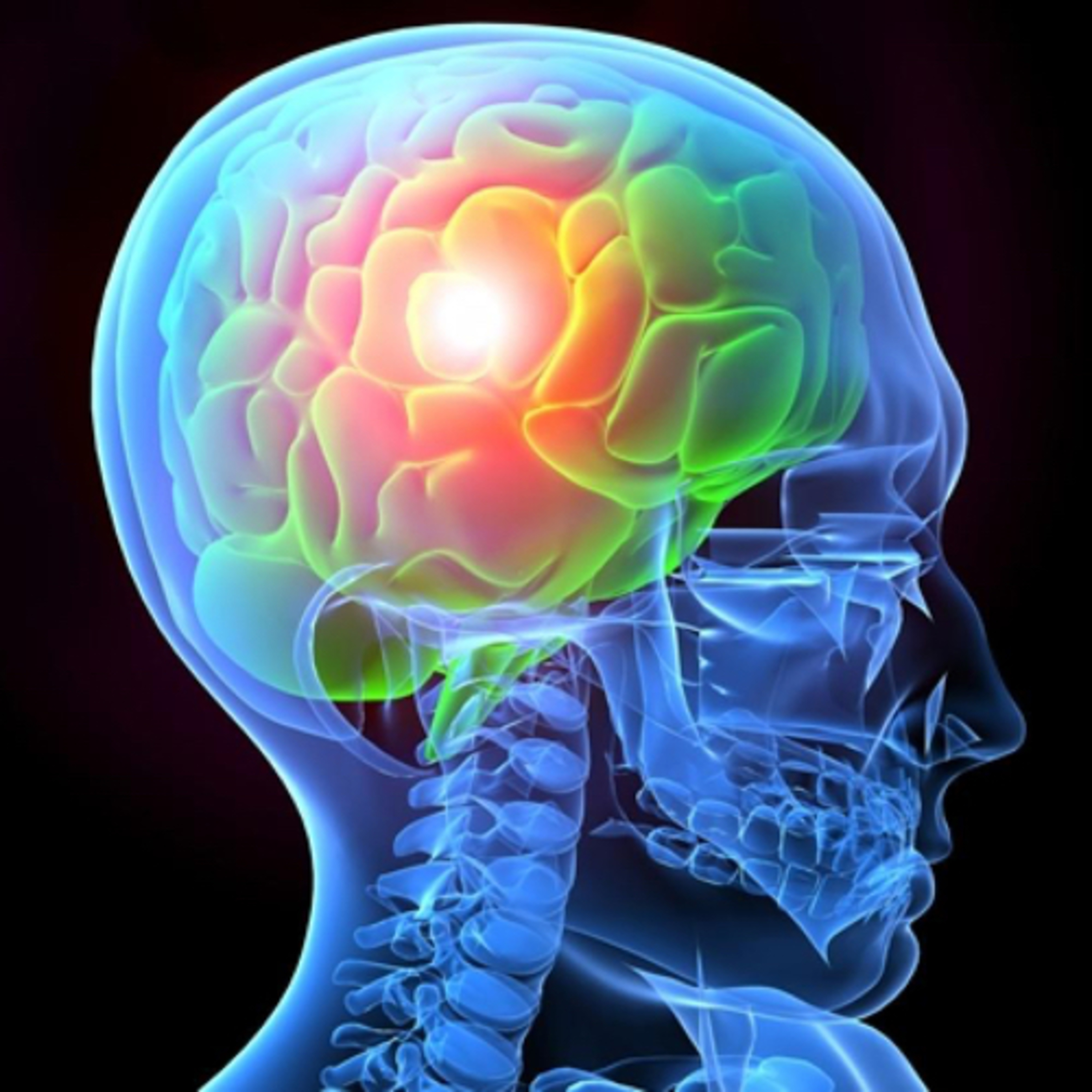 Insight on Concussions  episode artwork