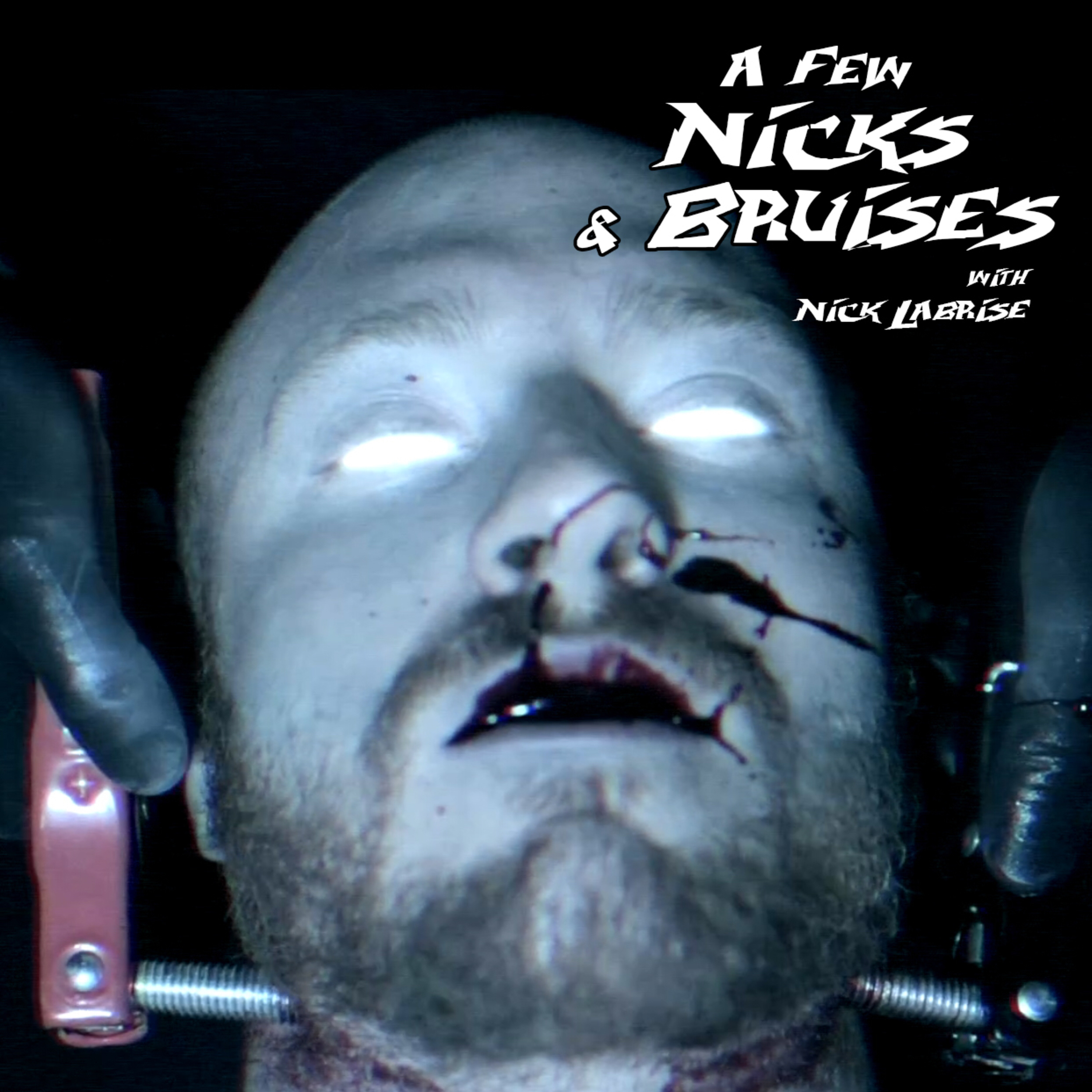 A Few Nicks and Bruises