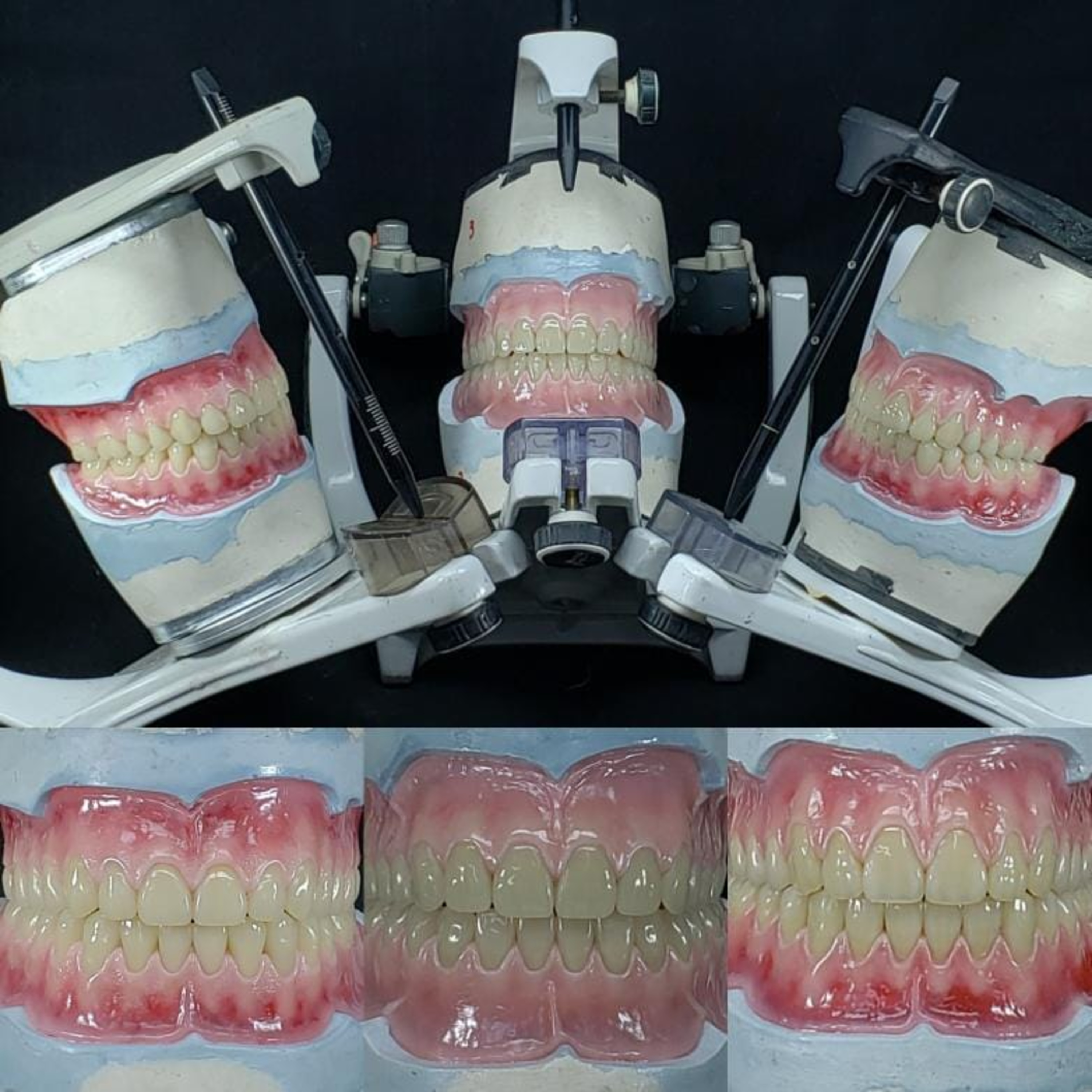 Episódio 73 - Escultura de Gengiva de Acordo com a Morfologia Dental com Angelo Rossett episode artwork