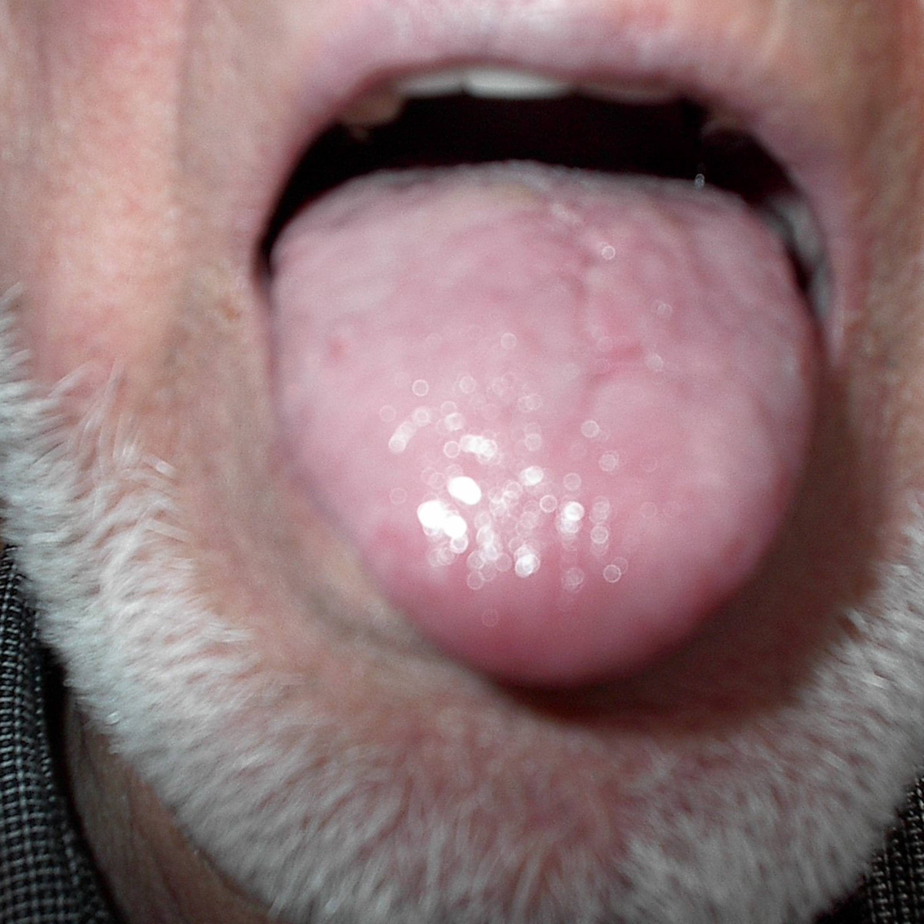Stick Out Your Tongue and Say \