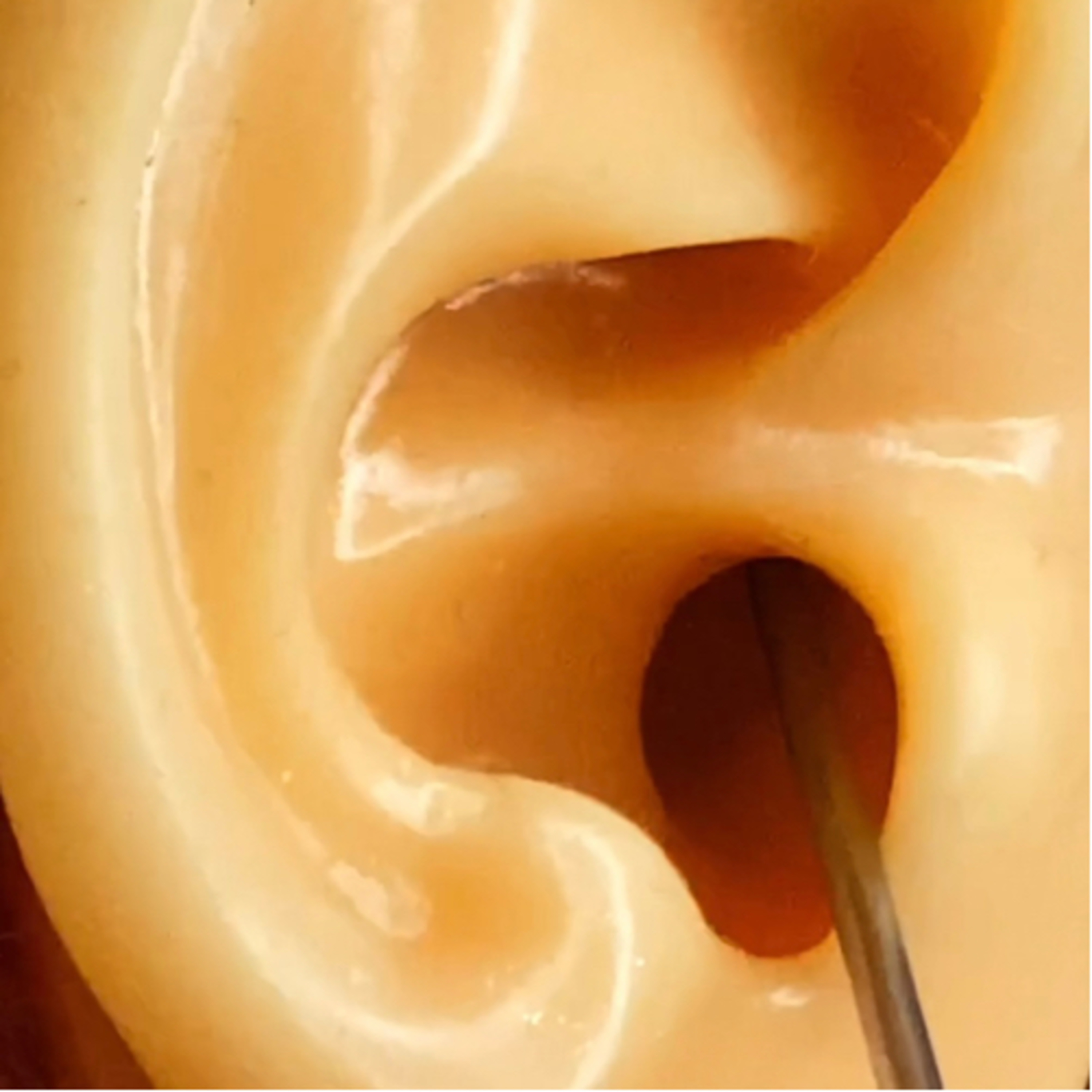 Ear cleaning… episode artwork