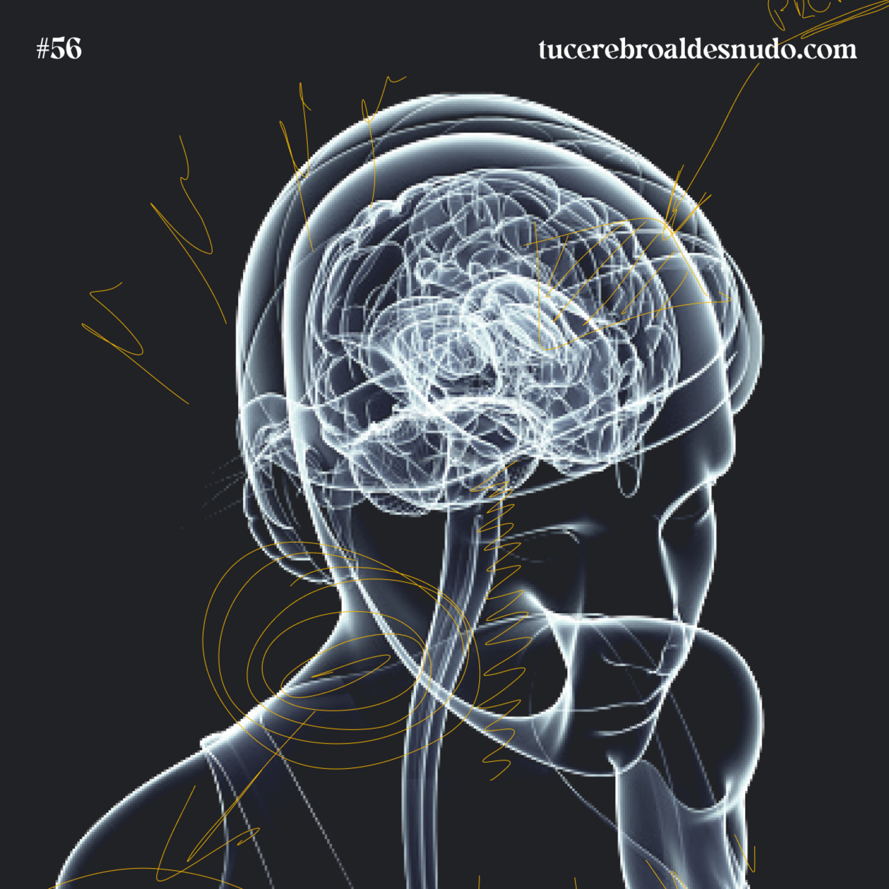 Cerebro Injodible®