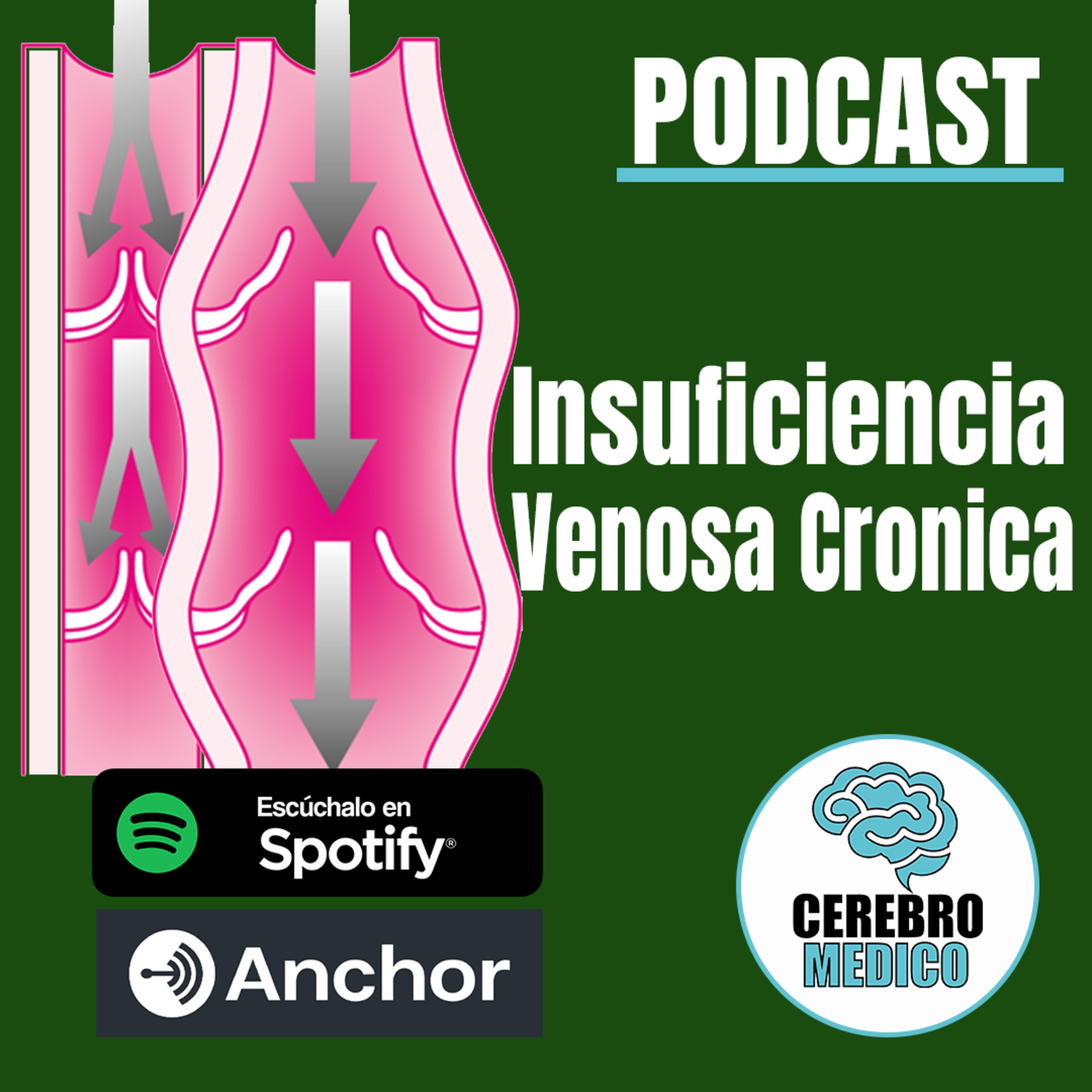 Insuficiencia Venosa Crónica
