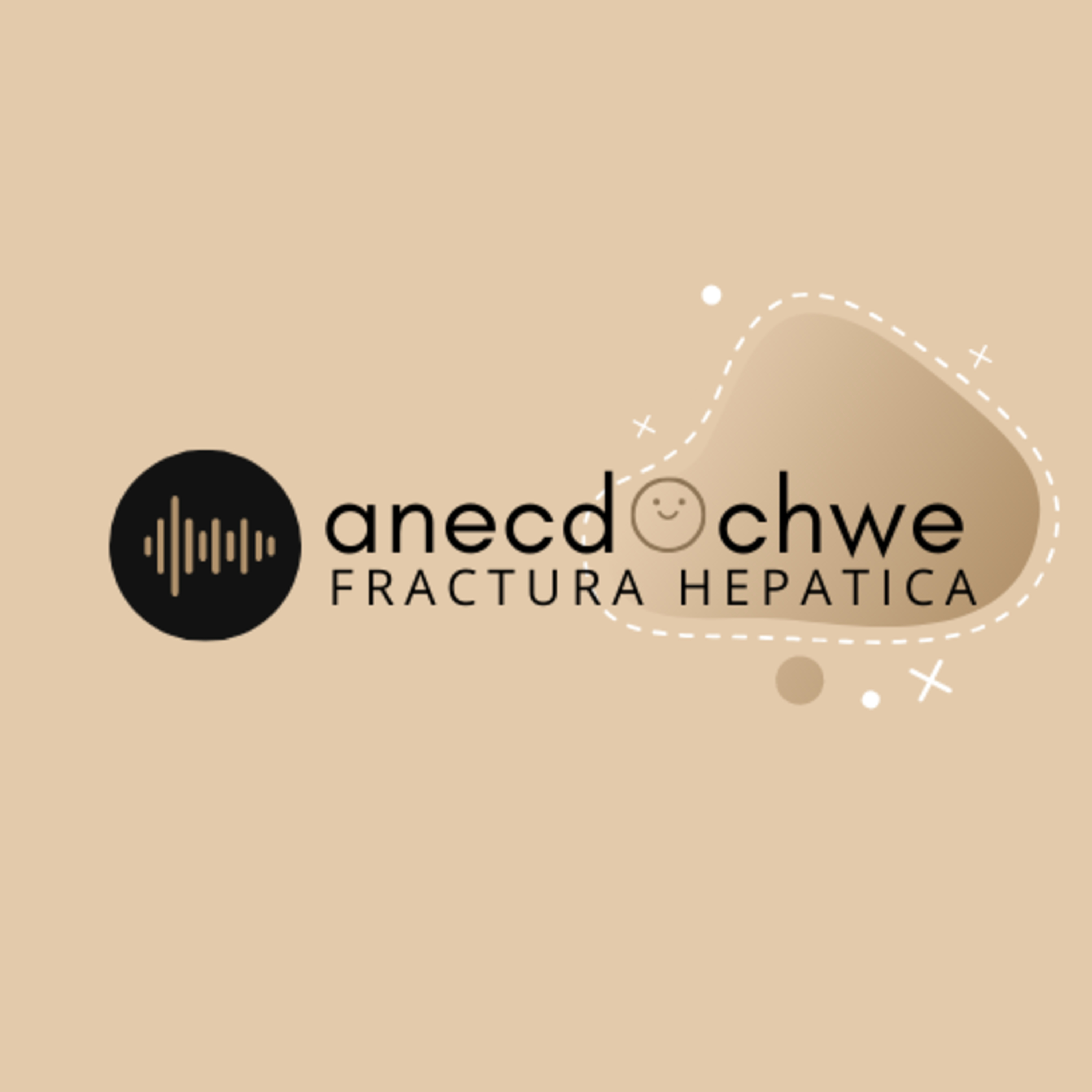 Anecdochwe