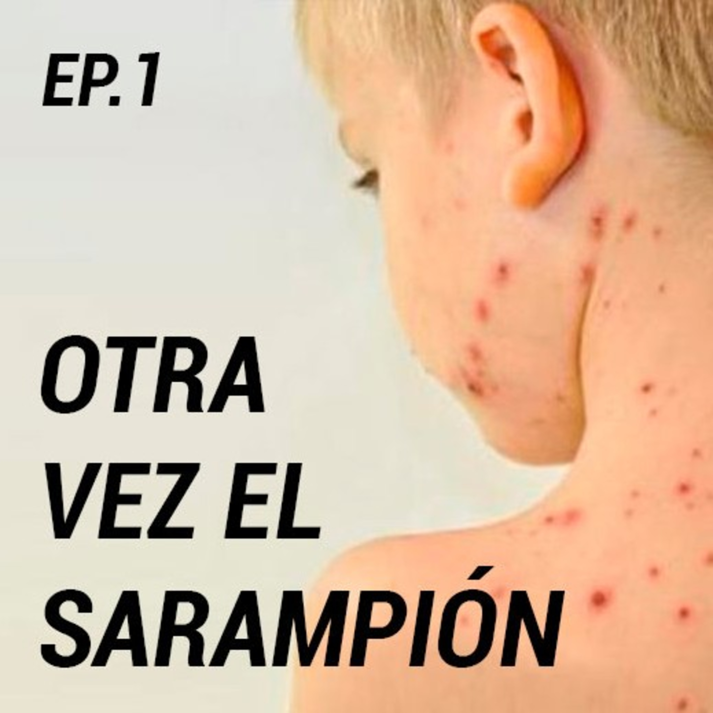 OTRA VEZ EL SARAMPIÓN - Episodio #1 episode artwork