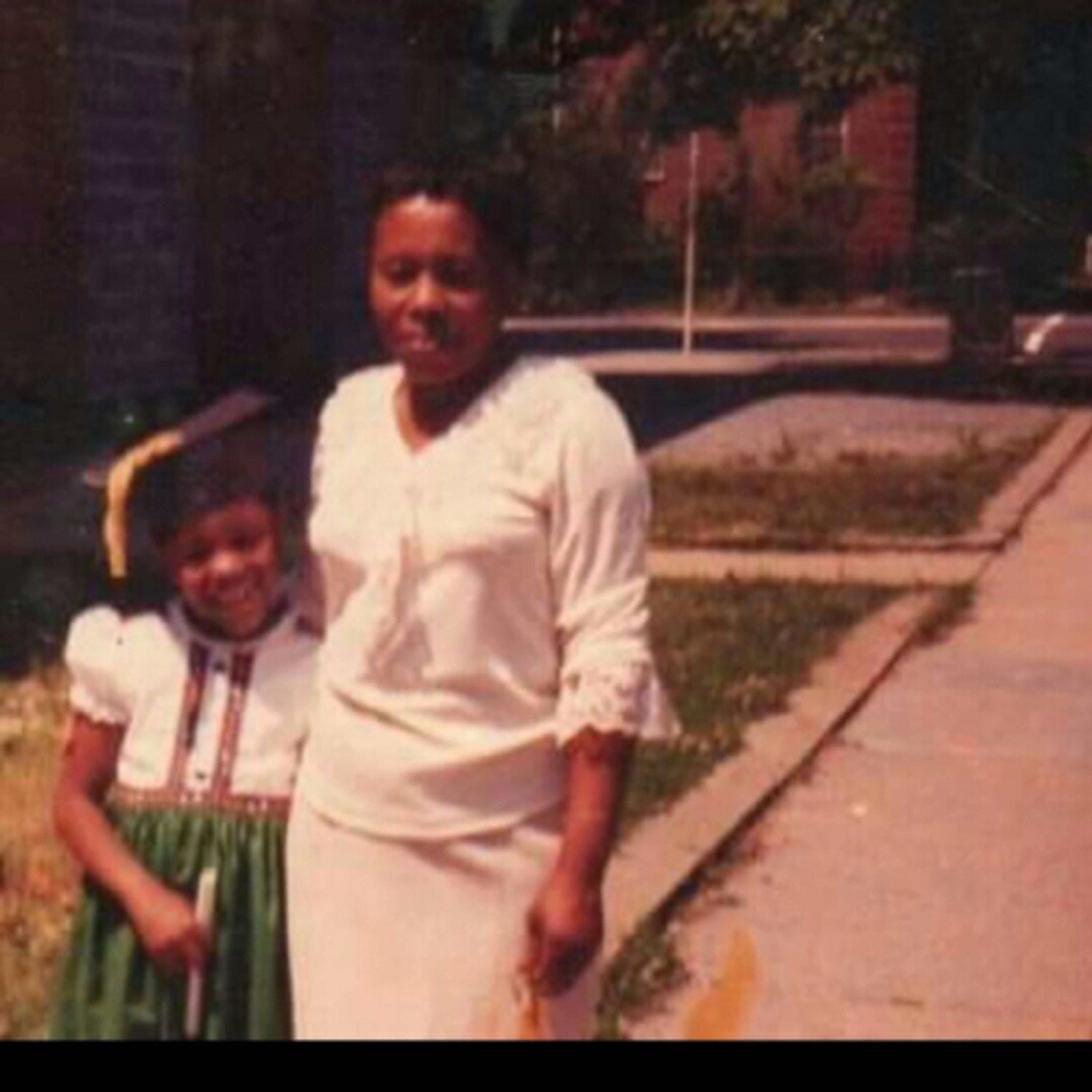 Bold Beautiful Alopecia Baldie