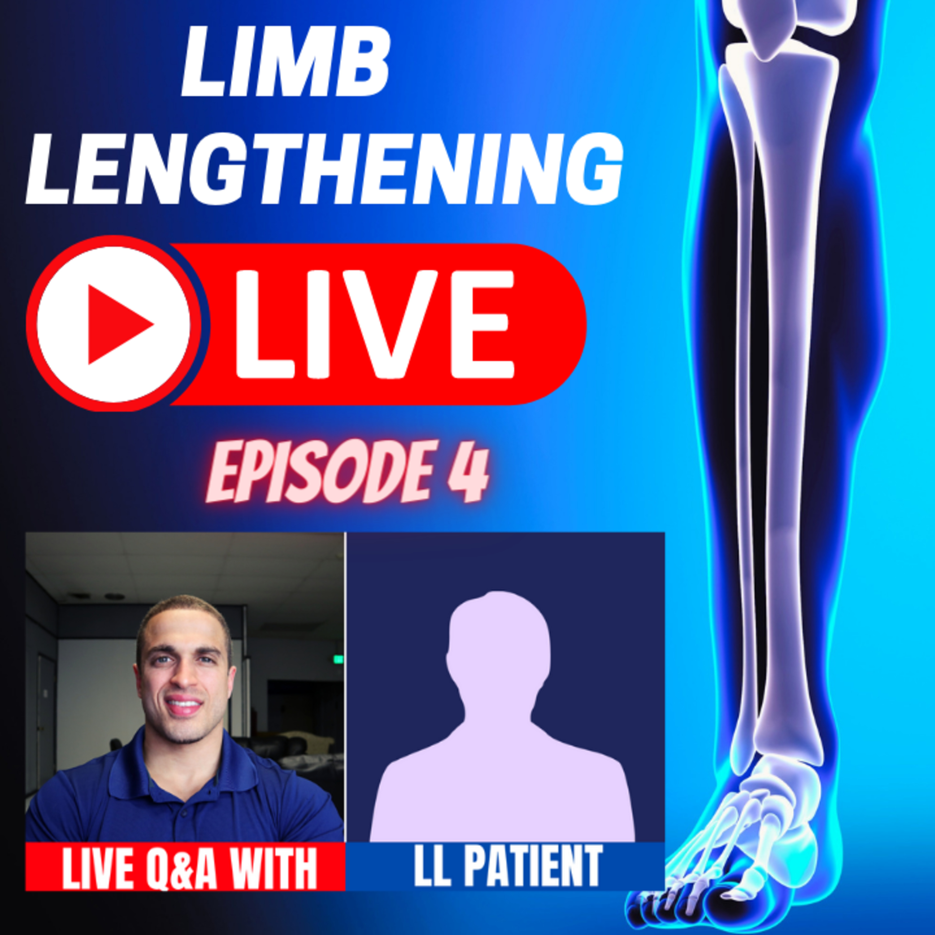 Leg Lengthening Podcast Episode 38 - Limb Lengthening LIVE Episode 4: Cosmetic Stature Lengthening Patient - LIVE Q&A