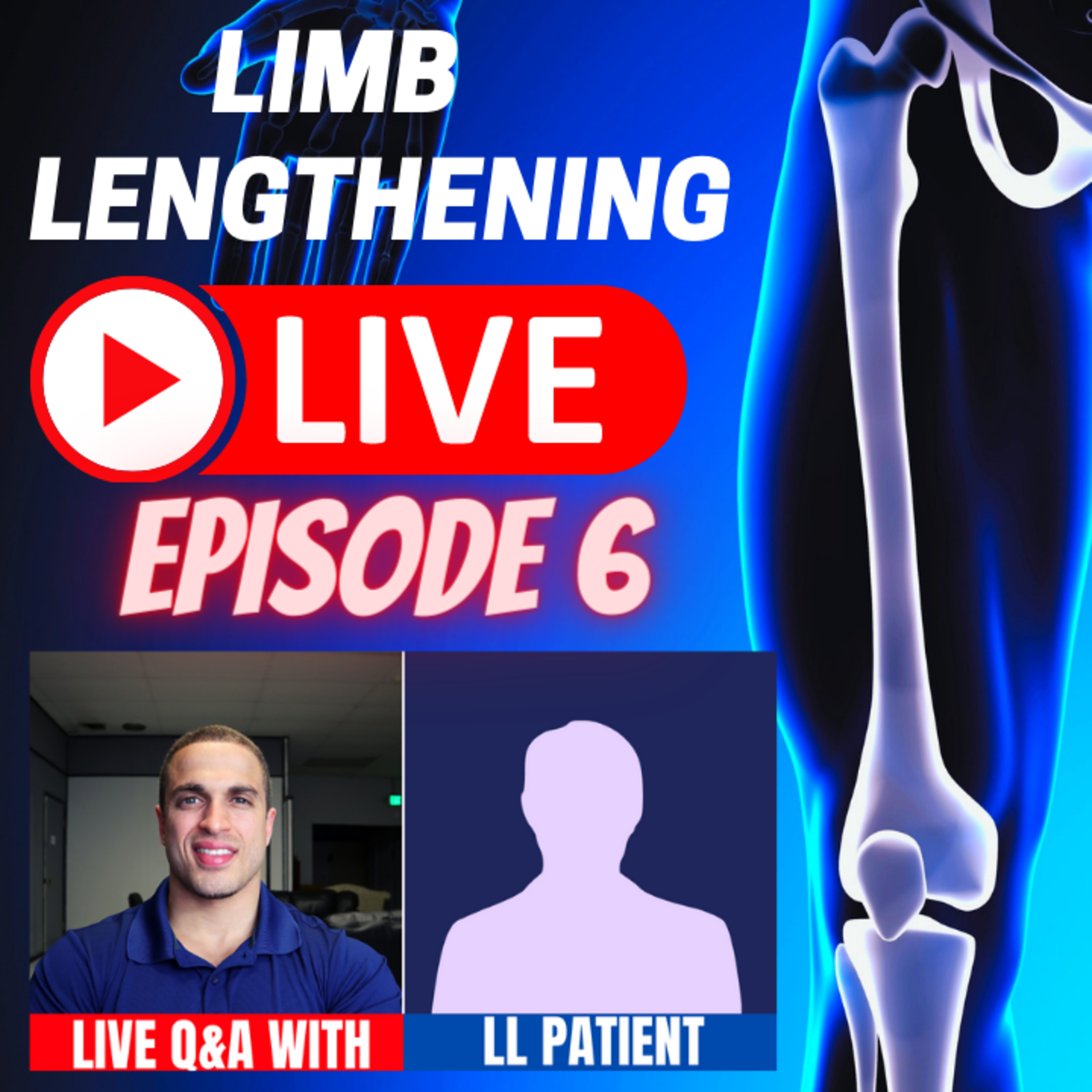 Leg Lengthening Podcast Episode 39 - Limb Lengthening LIVE Episode 6: Cosmetic Stature Lengthening Patient CLARK - LIVE Q&A