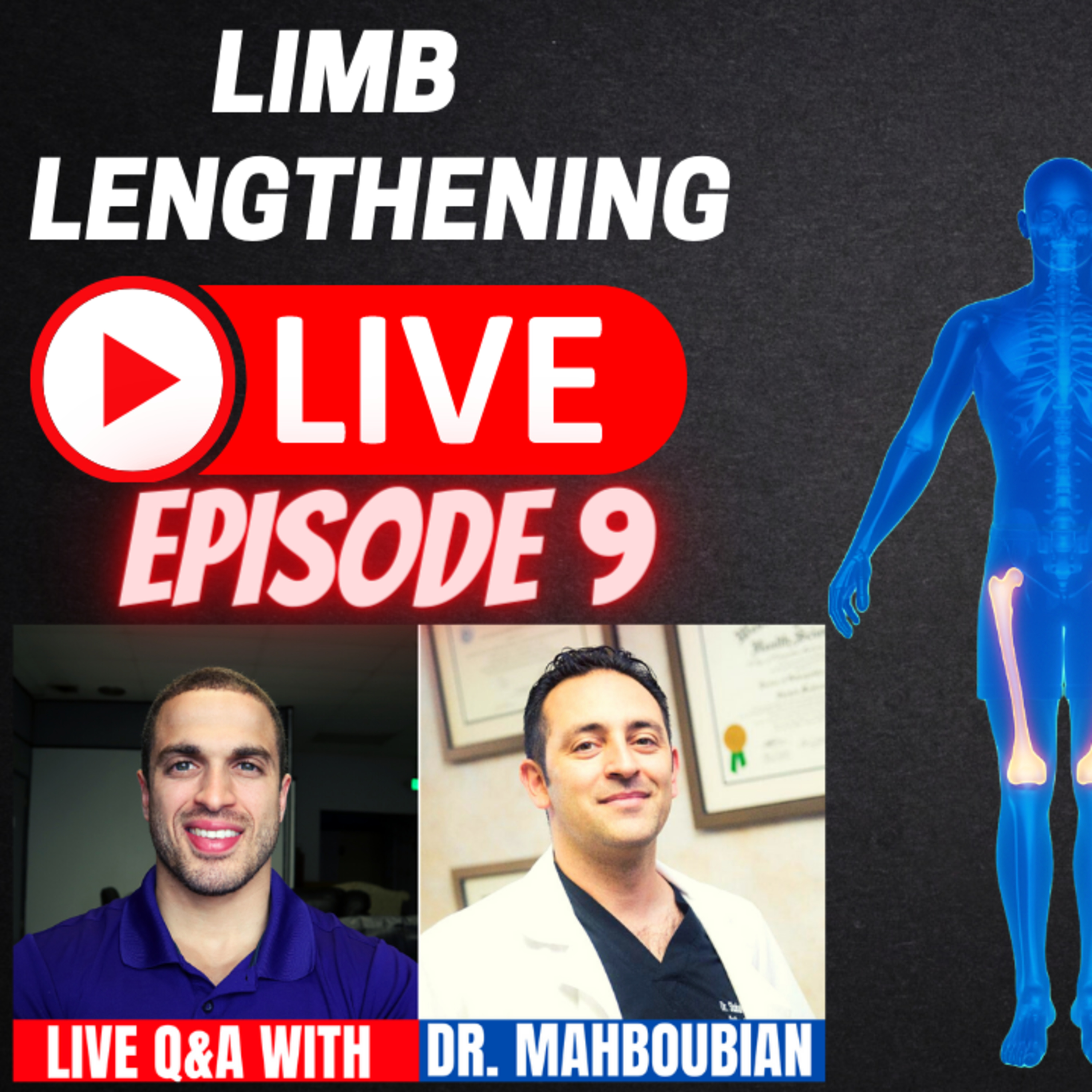 Leg Lengthening Podcast Episode 42 - Limb Lengthening LIVE Episode 9: Dr. Mahboubian of Height Lengthening in Los Angeles, CA - LIVE Q&A