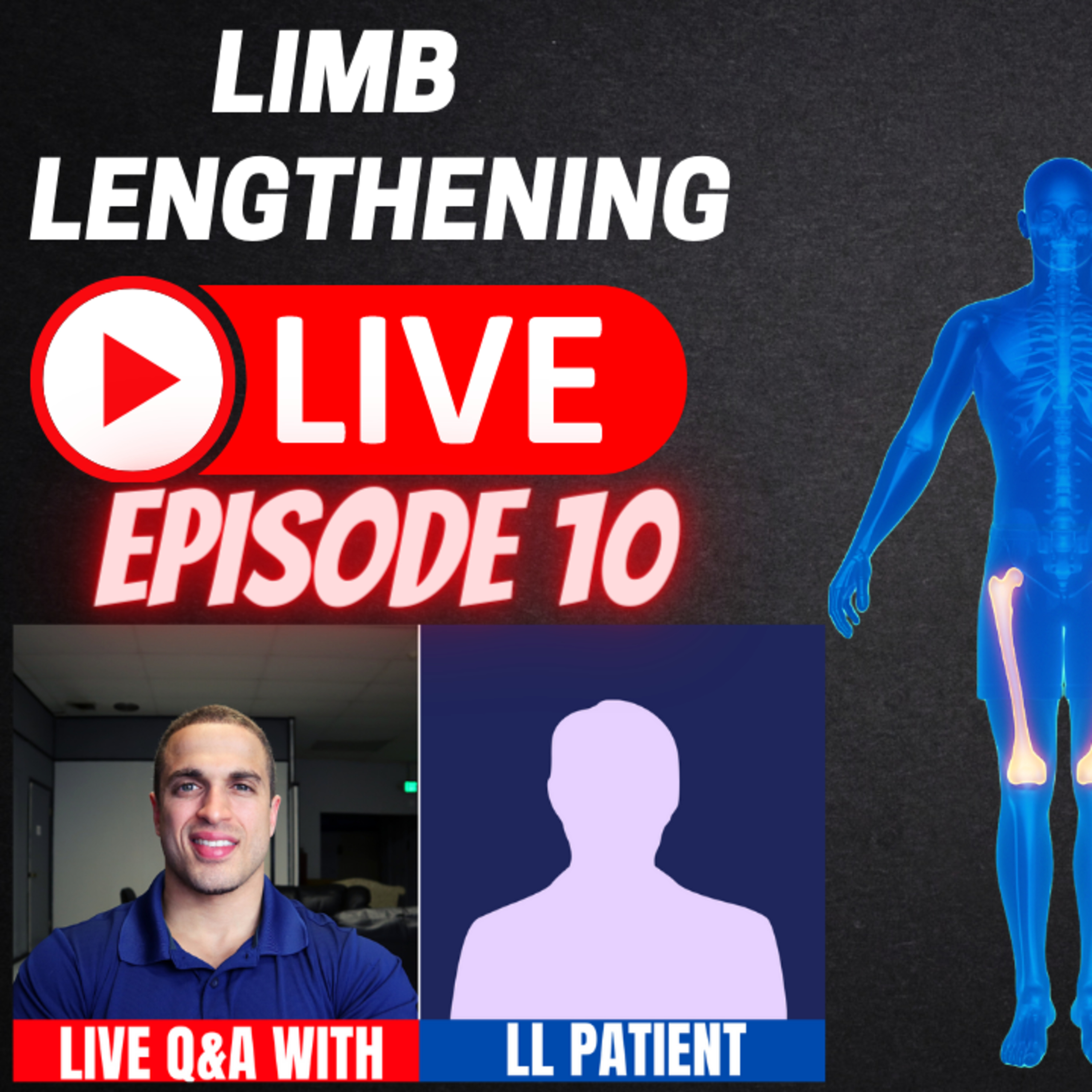 Limb Lengthening Podcast