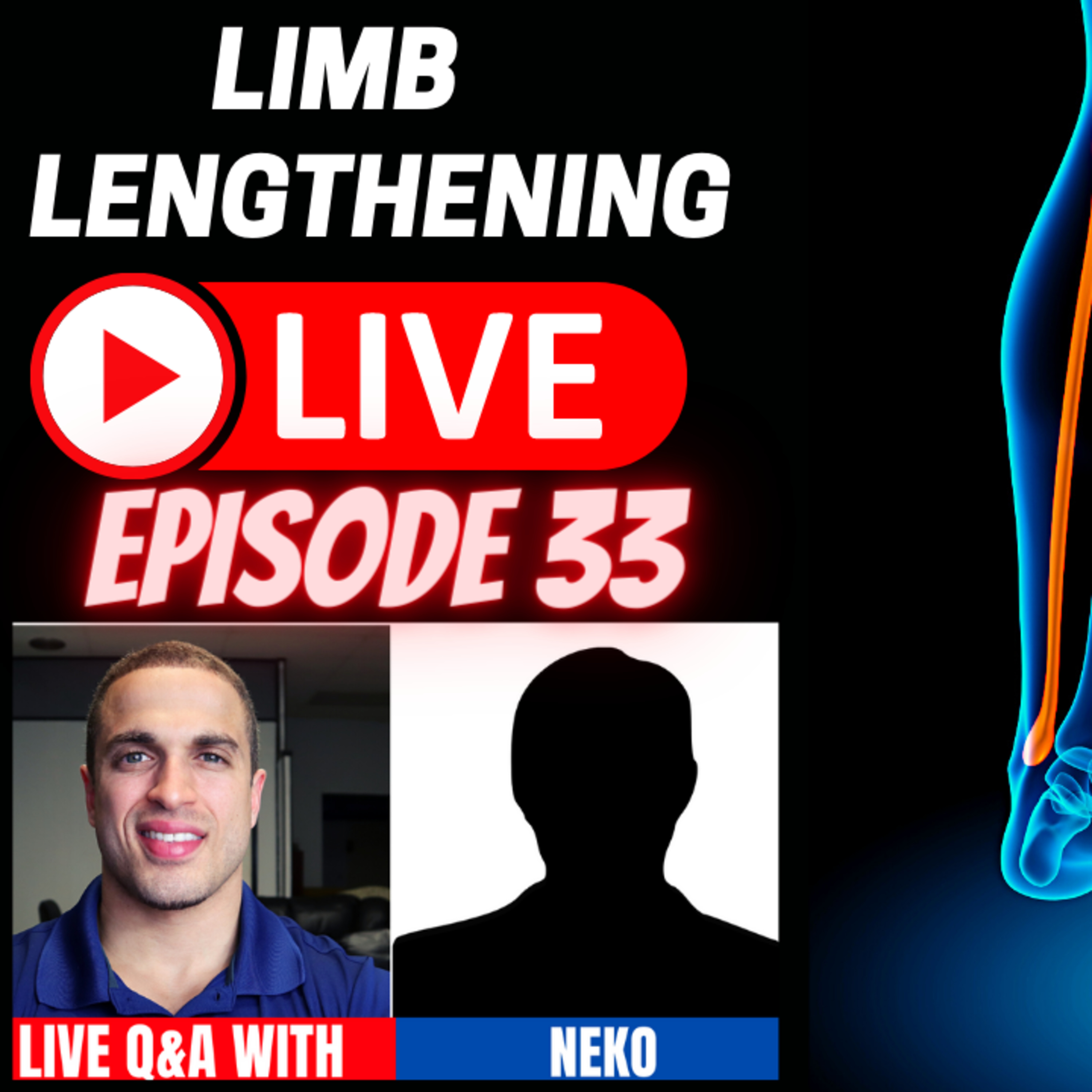 Leg Lengthening Podcast Episode 64 - Limb Lengthening LIVE Episode 33 - CLL Quadrilateral Patient - Neko