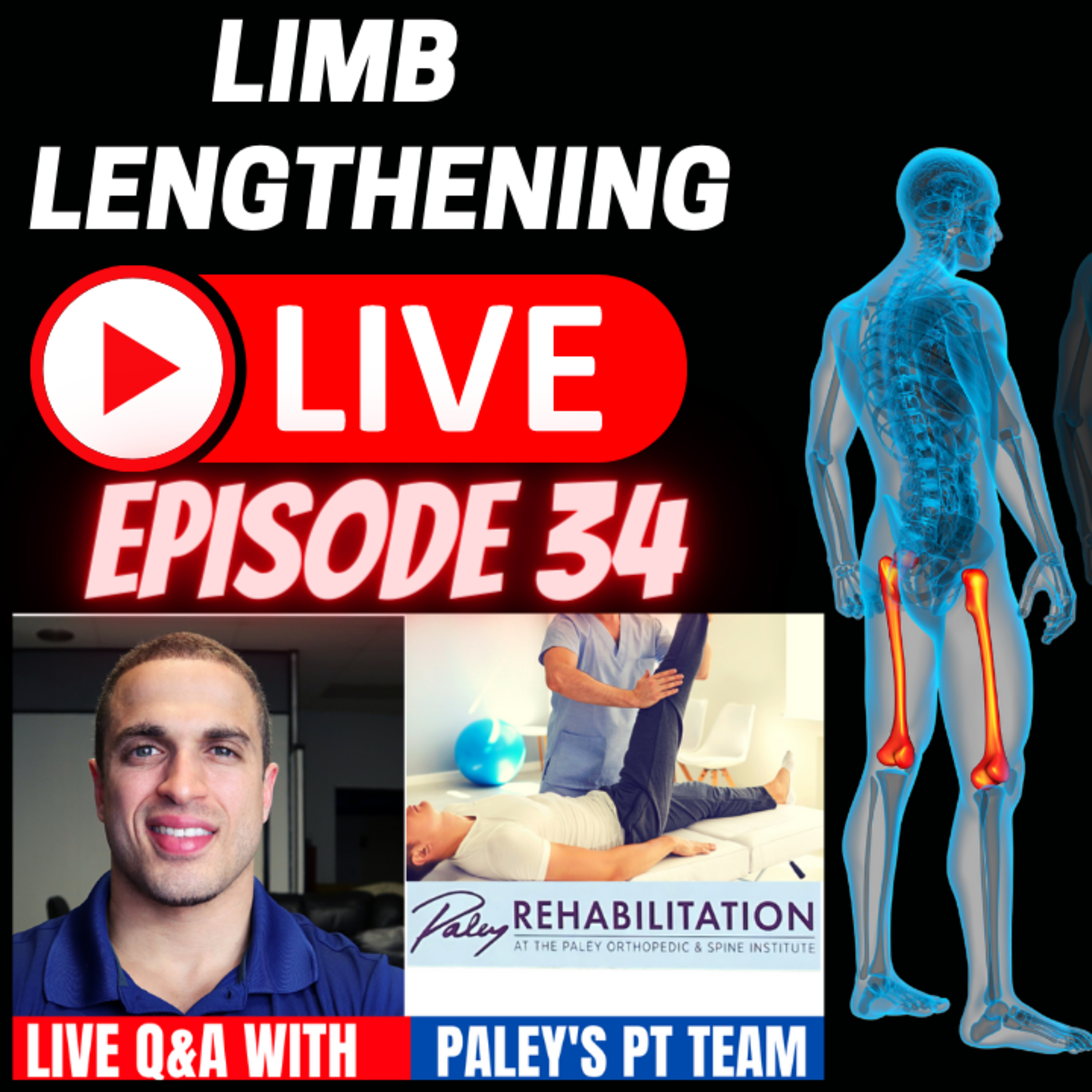 PART 2 - Leg Lengthening Podcast Episode 65 - Limb Lengthening LIVE Episode 34 - Paley's Physical Therapy Team