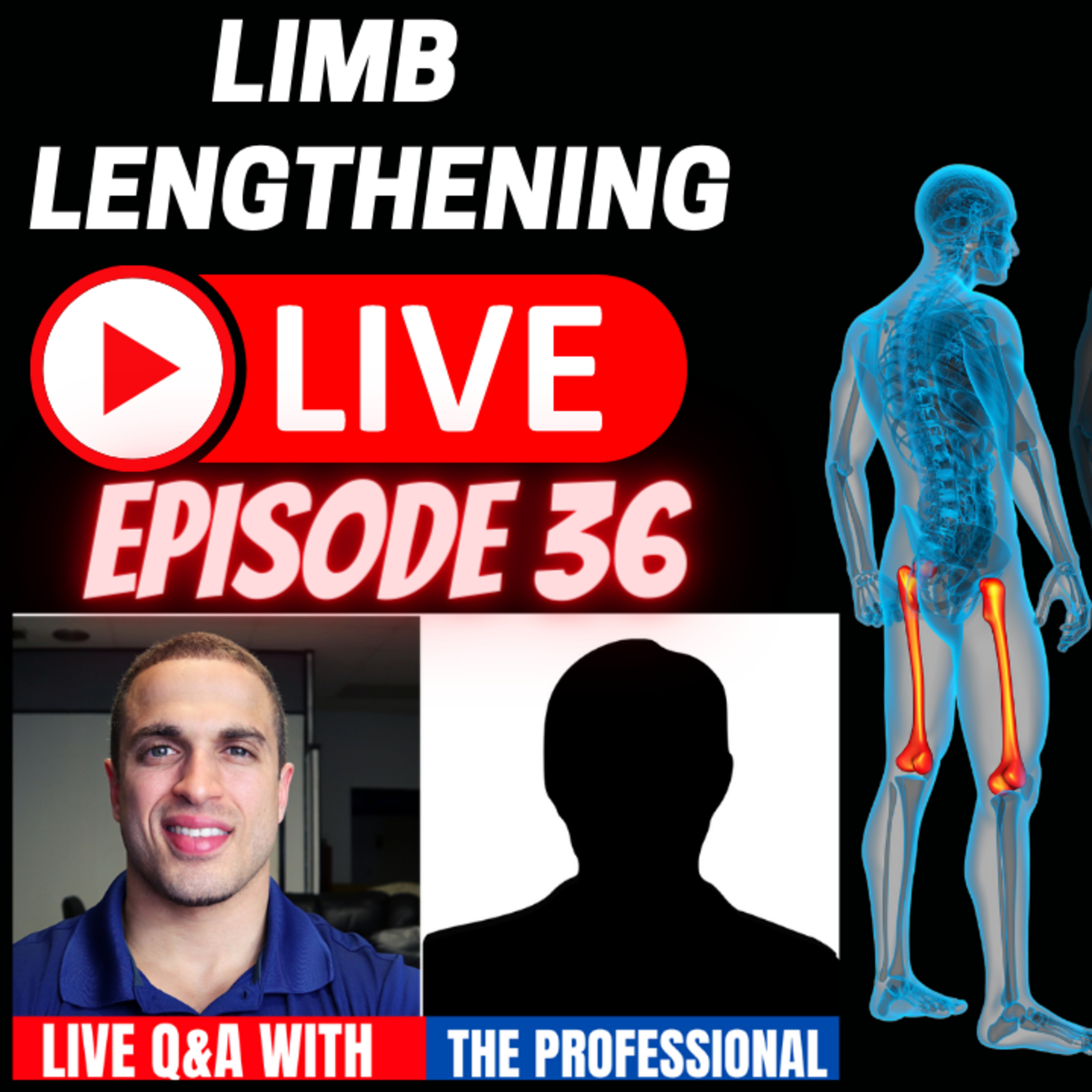 Leg Lengthening Podcast Episode 67 - Limb Lengthening LIVE Episode 36 - The Professional