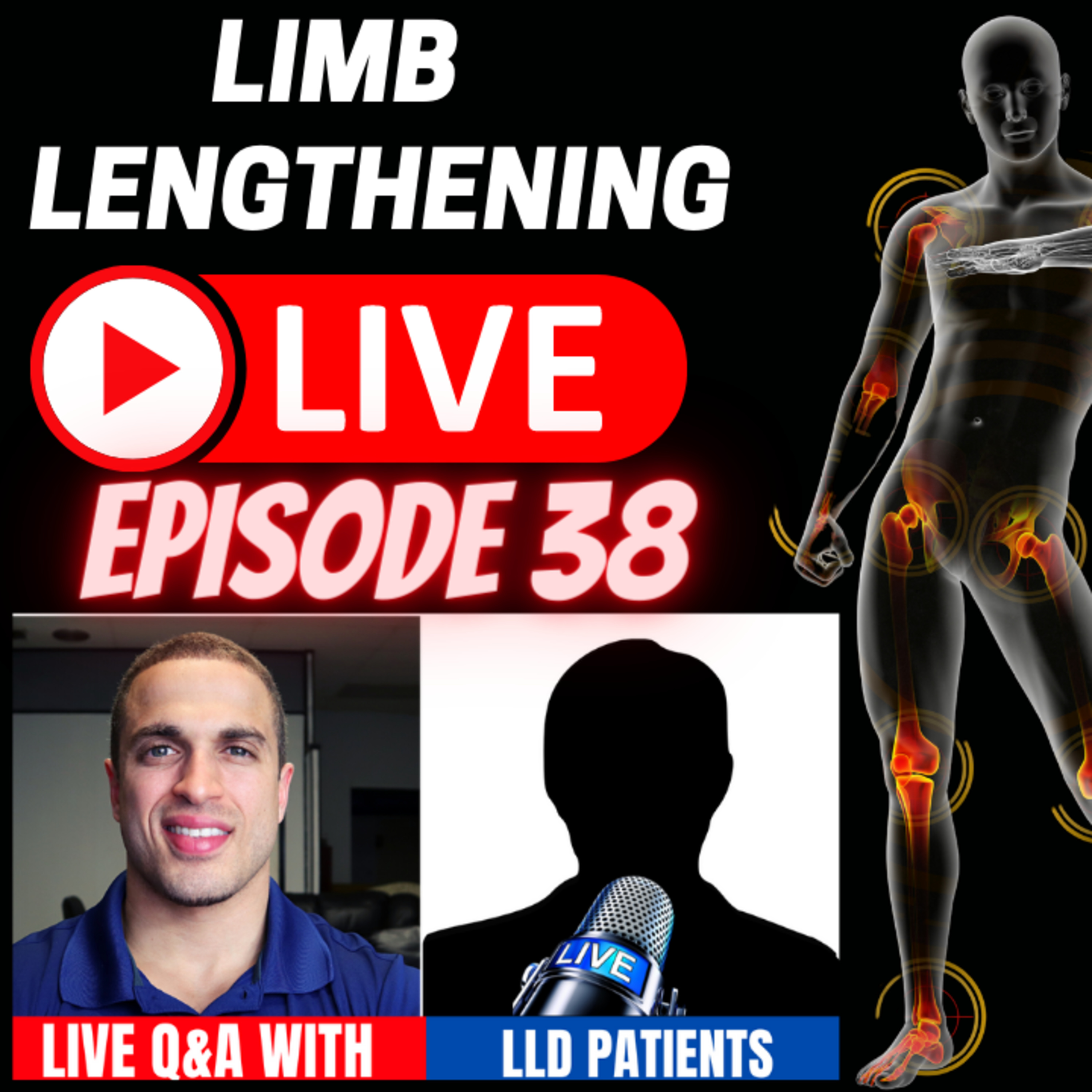 Leg Lengthening Podcast Episode 68 - Limb Lengthening LIVE Episode 38 - LLD Patient Matthew