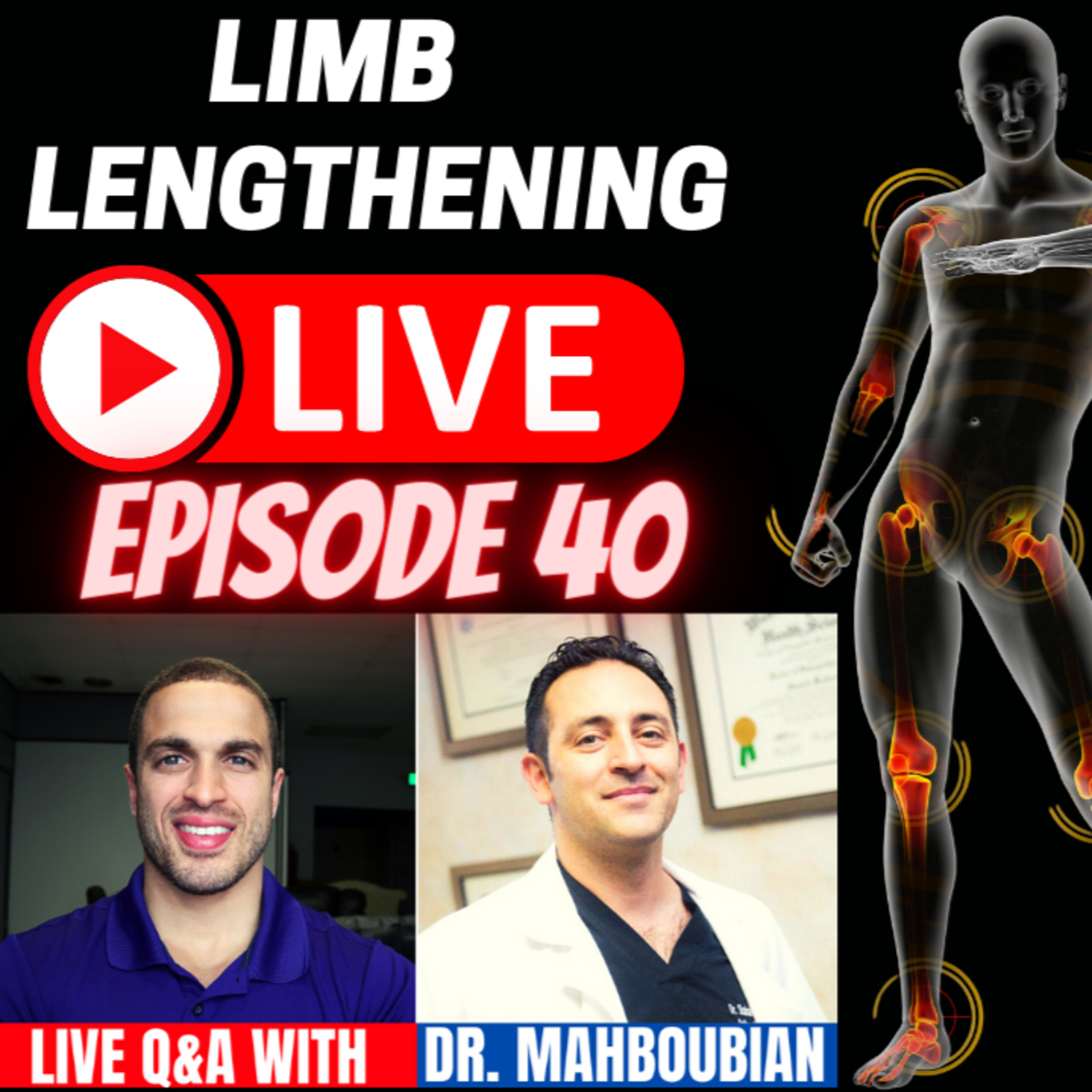 Limb Lengthening LIVE Episode 40 - Q&A w/ Dr. Shahab Mahboubian of Height Lengthening in Los Angeles, CA