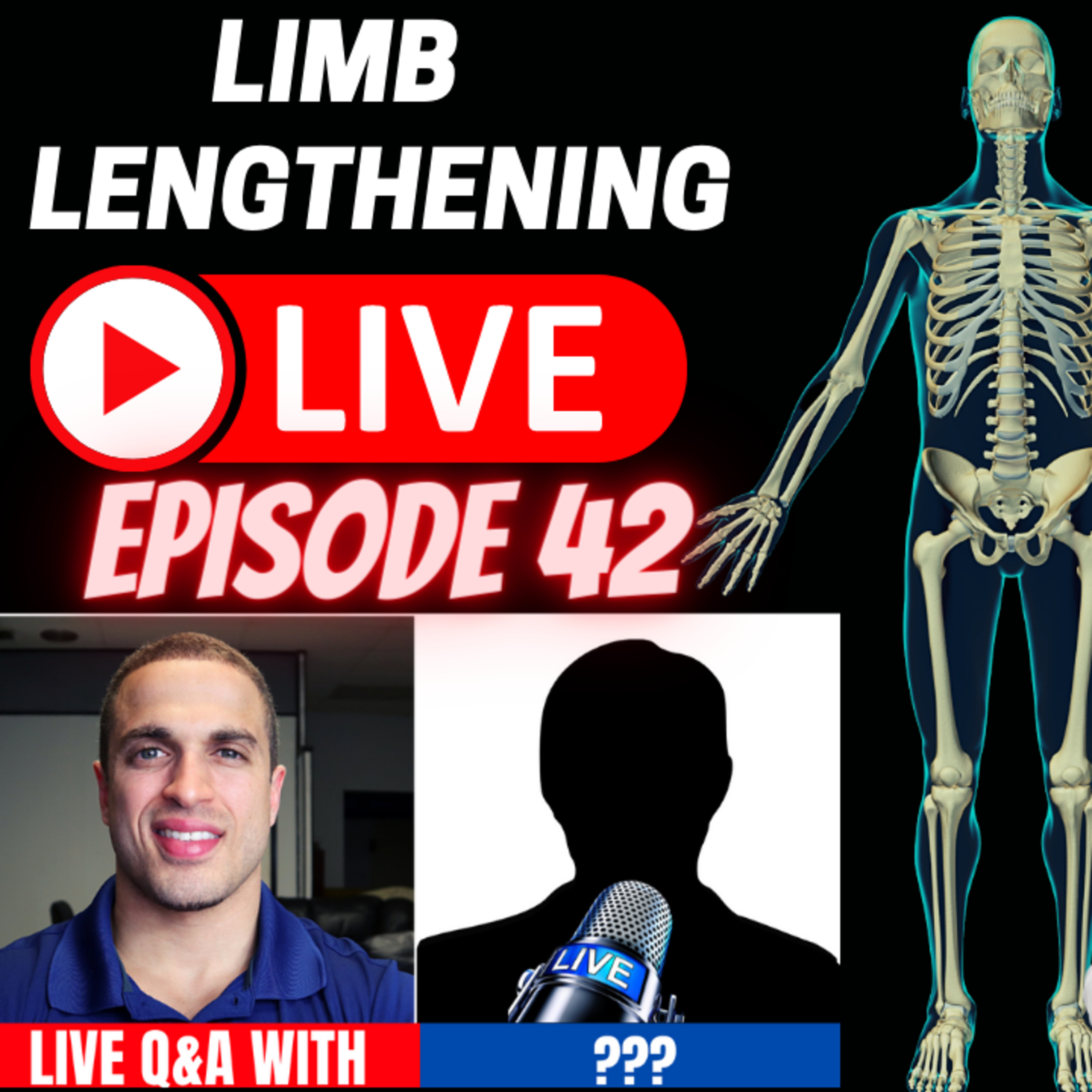 Limb Lengthening LIVE Episode 42 - Q&A w/ Victor & T joins the panel to talk about his LL process