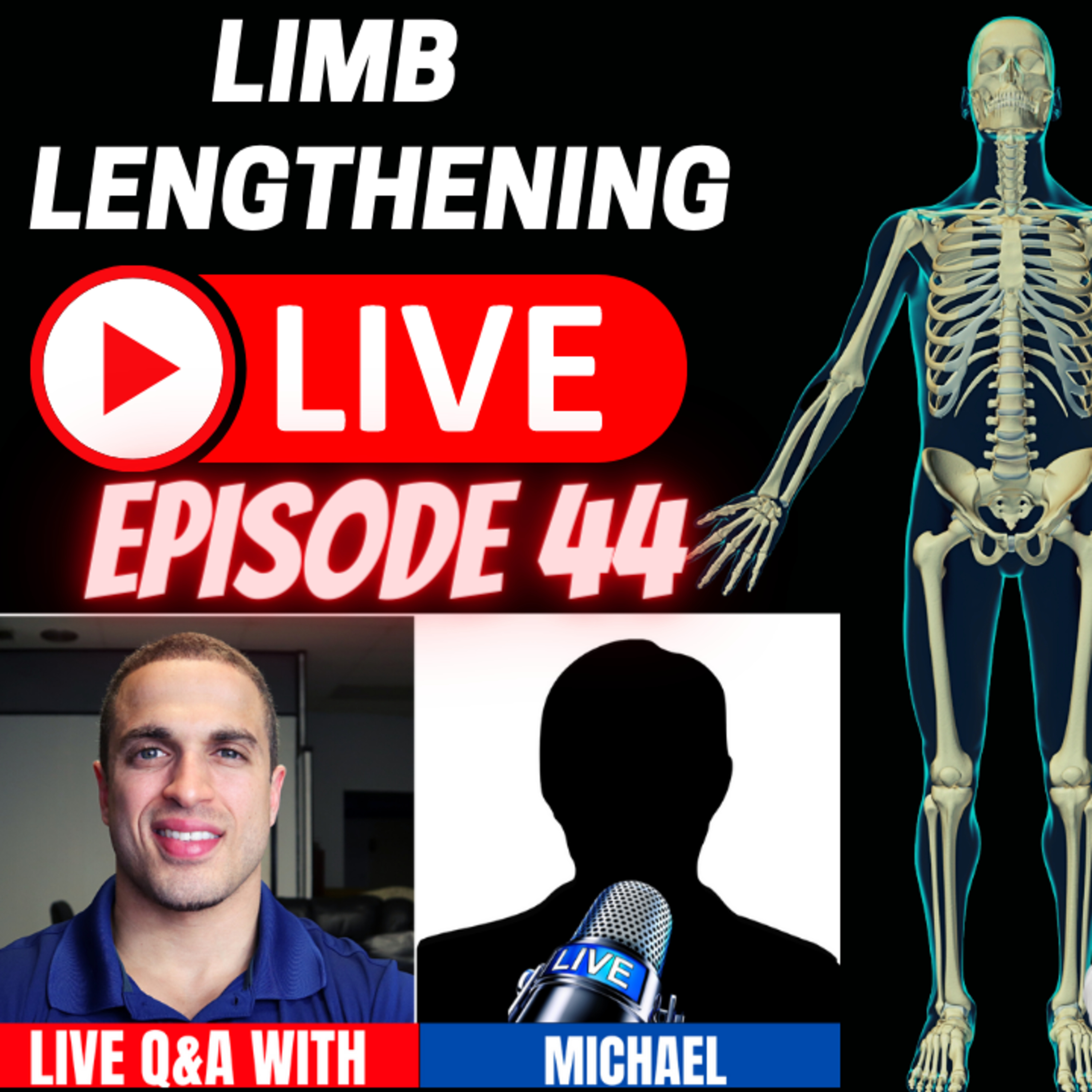 Limb Lengthening LIVE - Episode 44 - Interview + Q&A w/ Michael - Alternative LL Methods