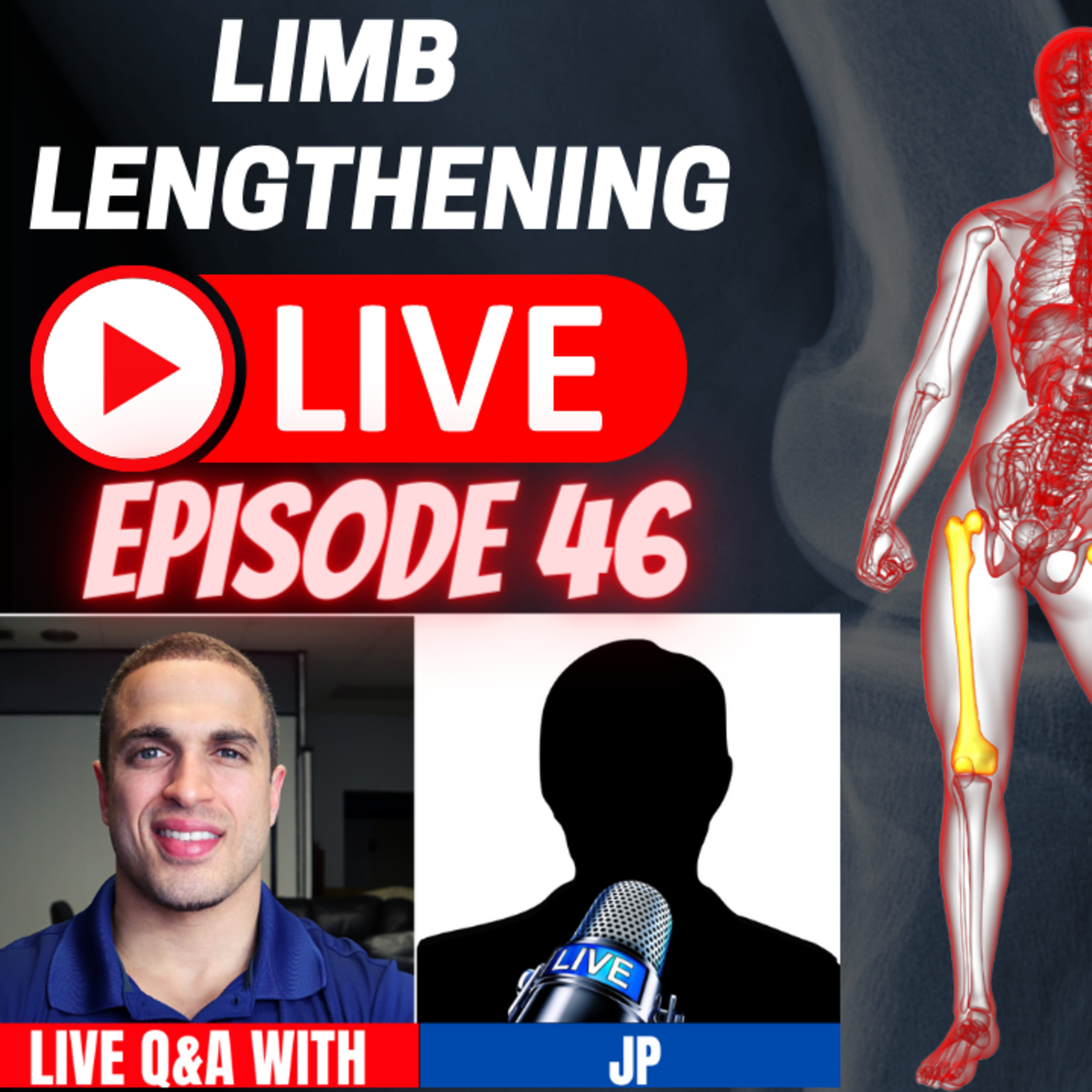 Limb Lengthening LIVE - Episode 46 - Interview w/ prospective LL patient JP