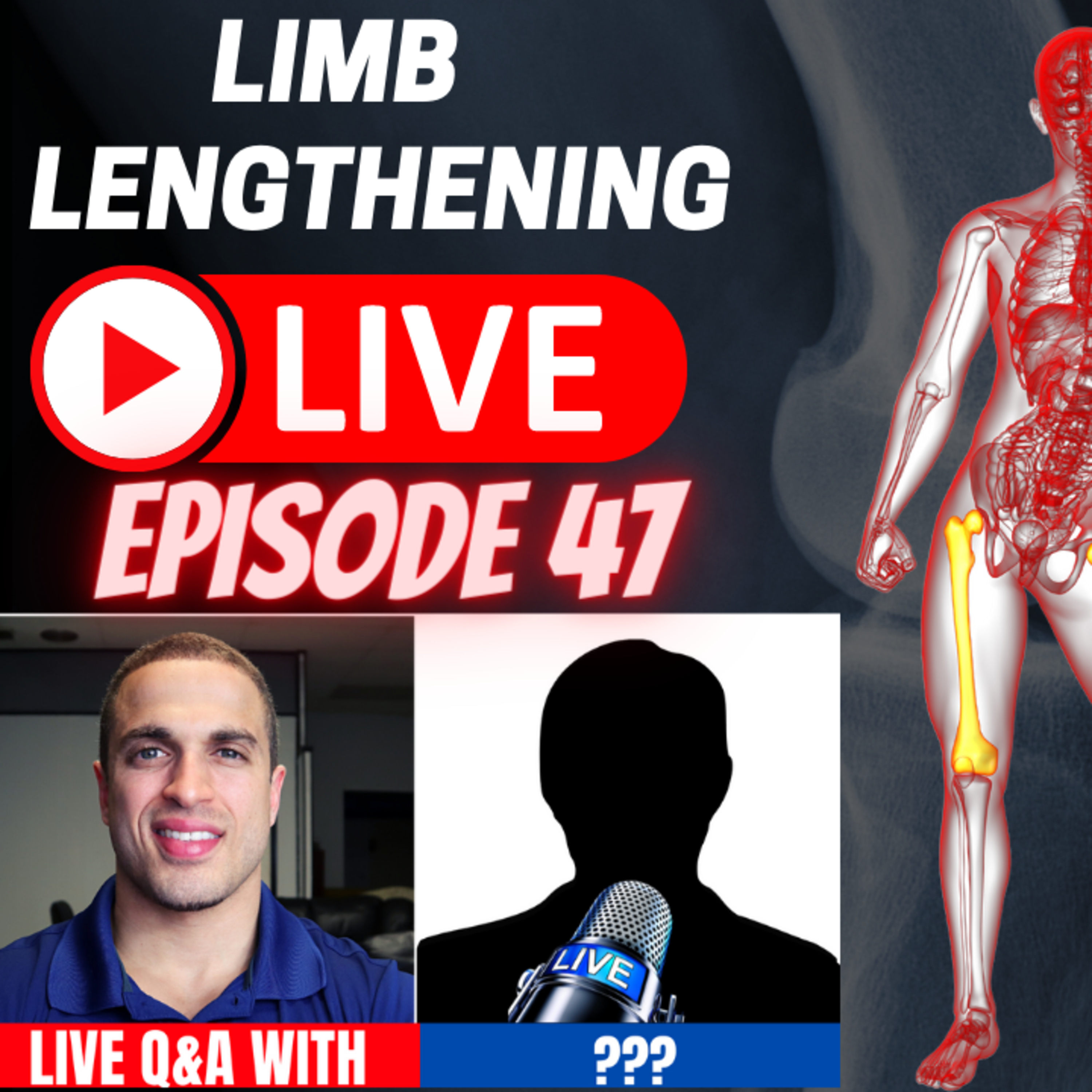 Limb Lengthening LIVE - Episode 47 - Open Mic Roundtable Q&A with Patients & Dr. Robbins