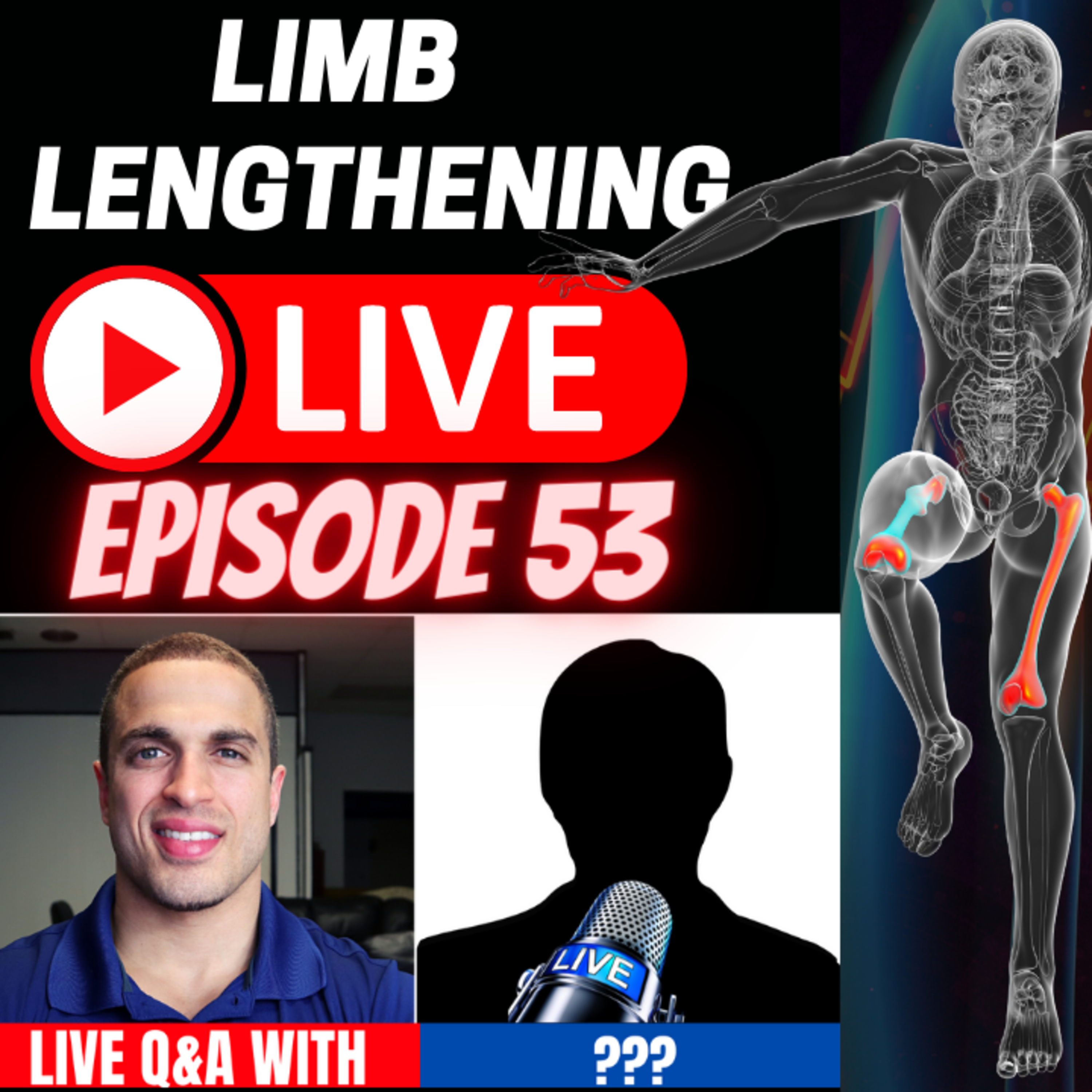 Episode 53 of LL LIVE - Limb Length Discrepancy (LLD) Patients - Omar & Francesco