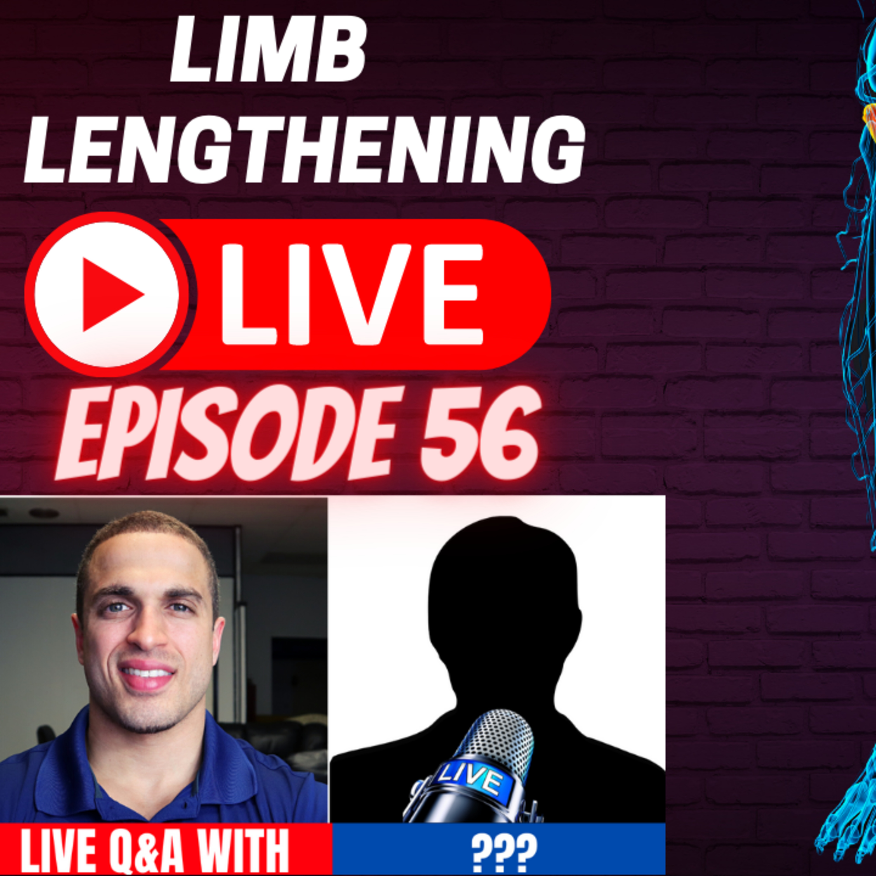 Limb Lengthening LIVE - Episode 56 - LIVE Roundtable with: Ath, Daniel, Mr. T and Peter