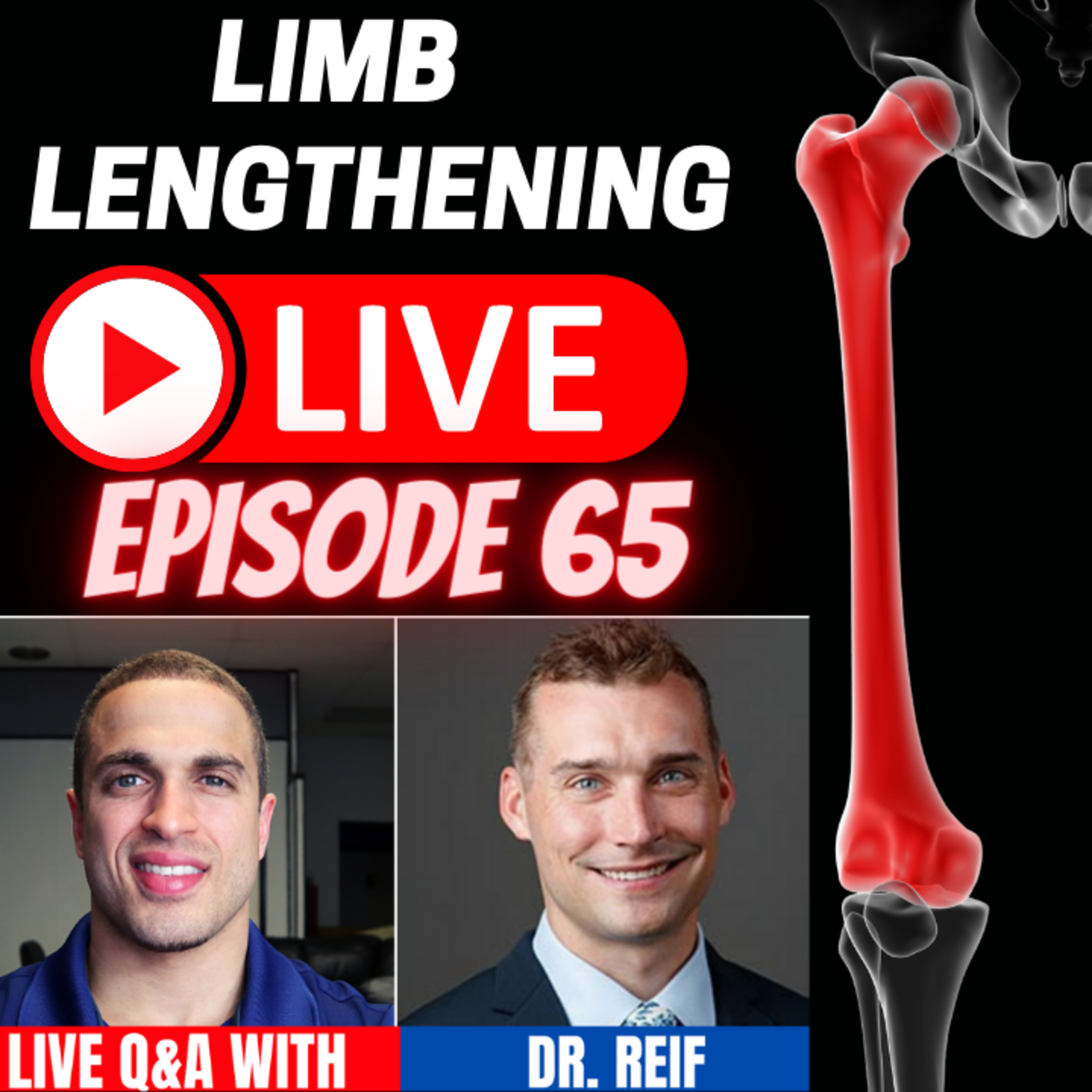 Limb Lengthening LIVE - Episode 65 - LIVE Presentation w/ Dr. Taylor Reif - HSS - New York, NY - USA