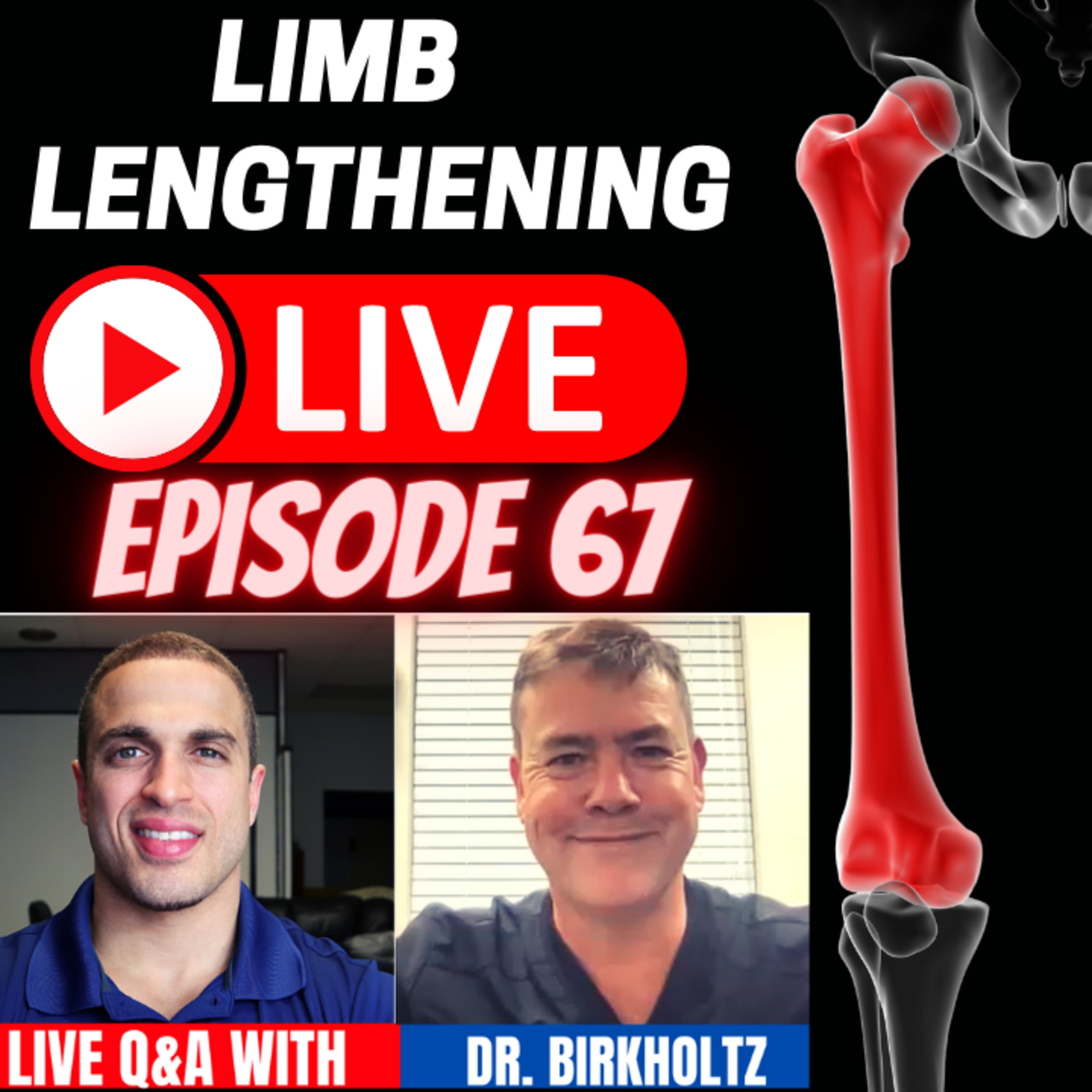 Limb Lengthening LIVE - Episode 67 - LIVE Presentation w/ Dr. Franz Birkholtz - South Africa