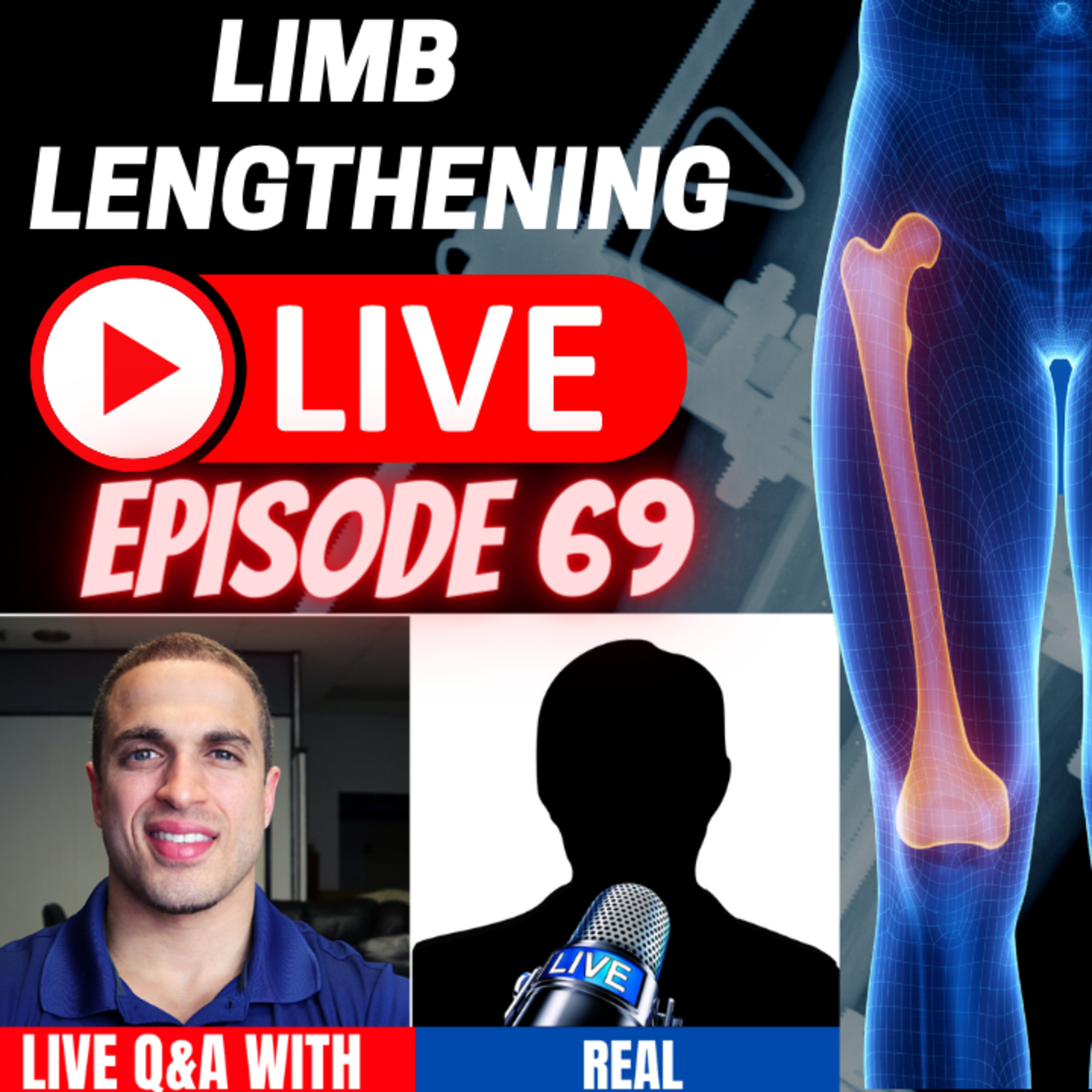 Limb Lengthening LIVE - Episode 69 - LIVE with CLL Patient - Real