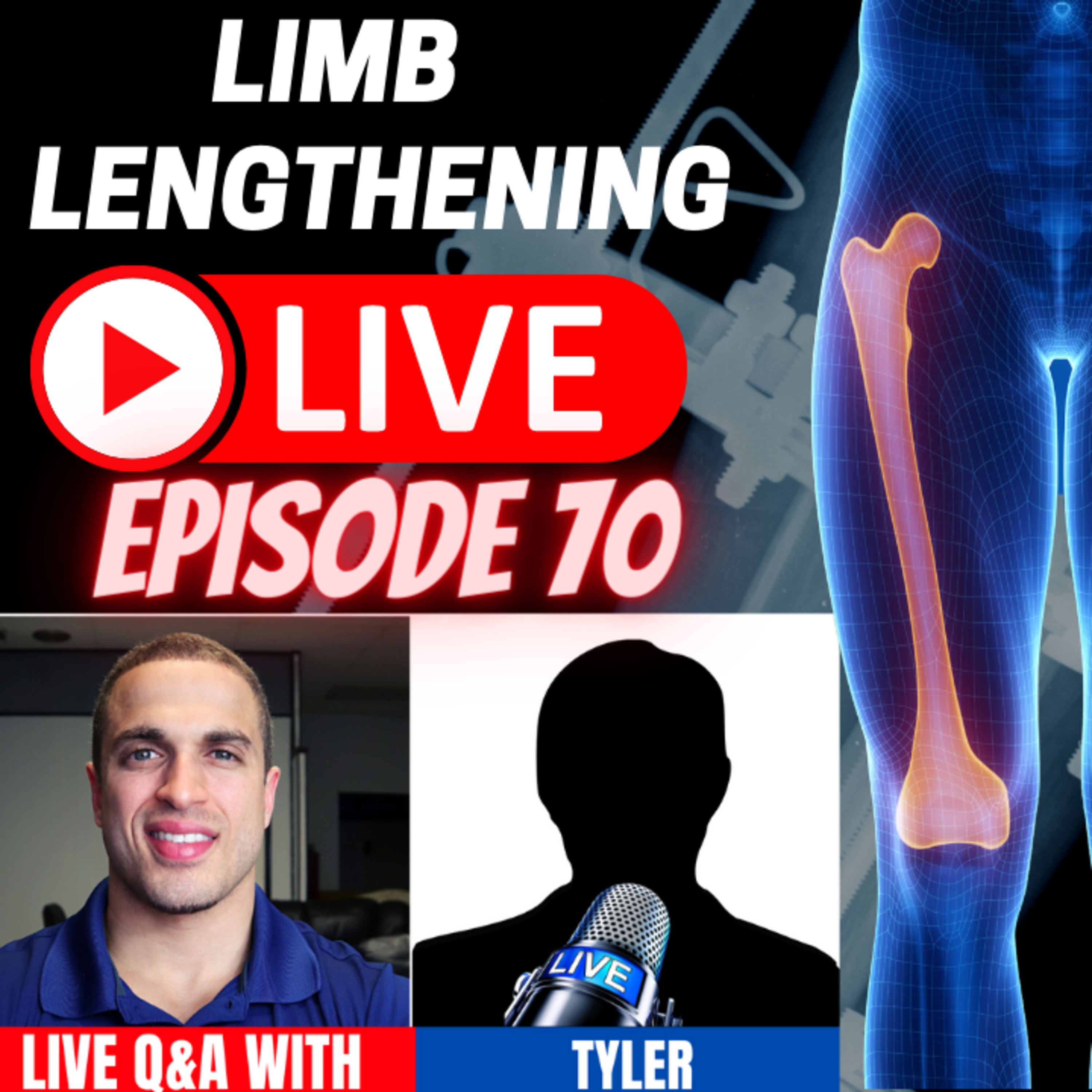 Limb Lengthening LIVE - Episode 70 - LIVE with Tyler of Natural Height Growth