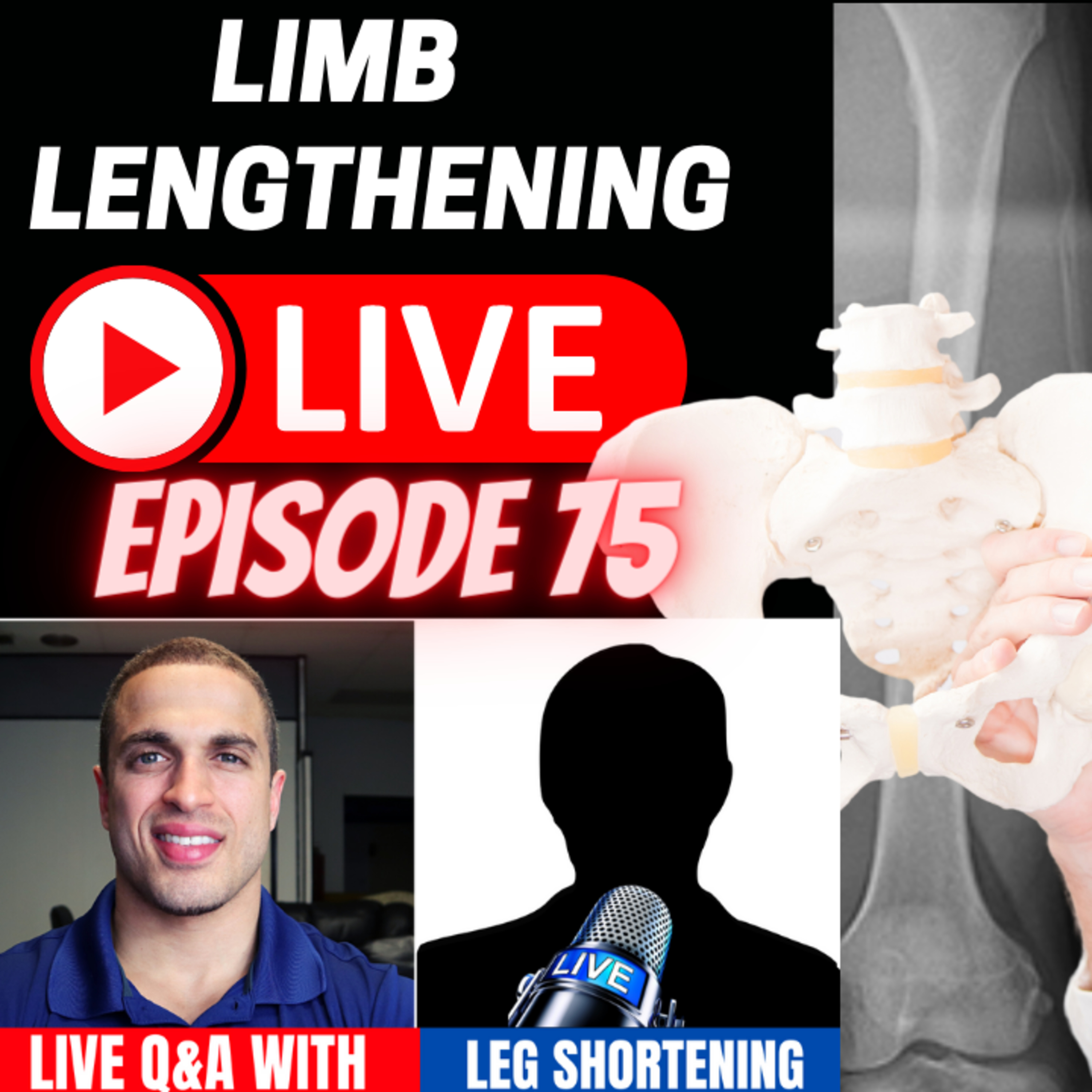 LL LIVE Episode 75 - Guest No Show so I did a quick update and Q&A