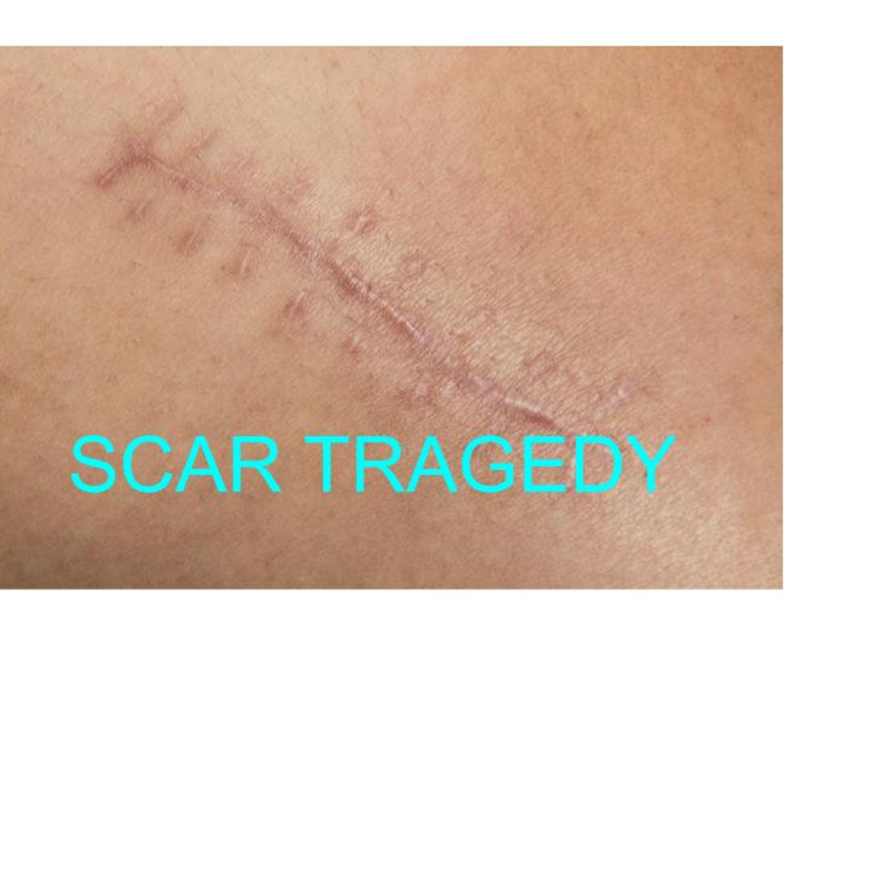 Scar Tragedy episode artwork
