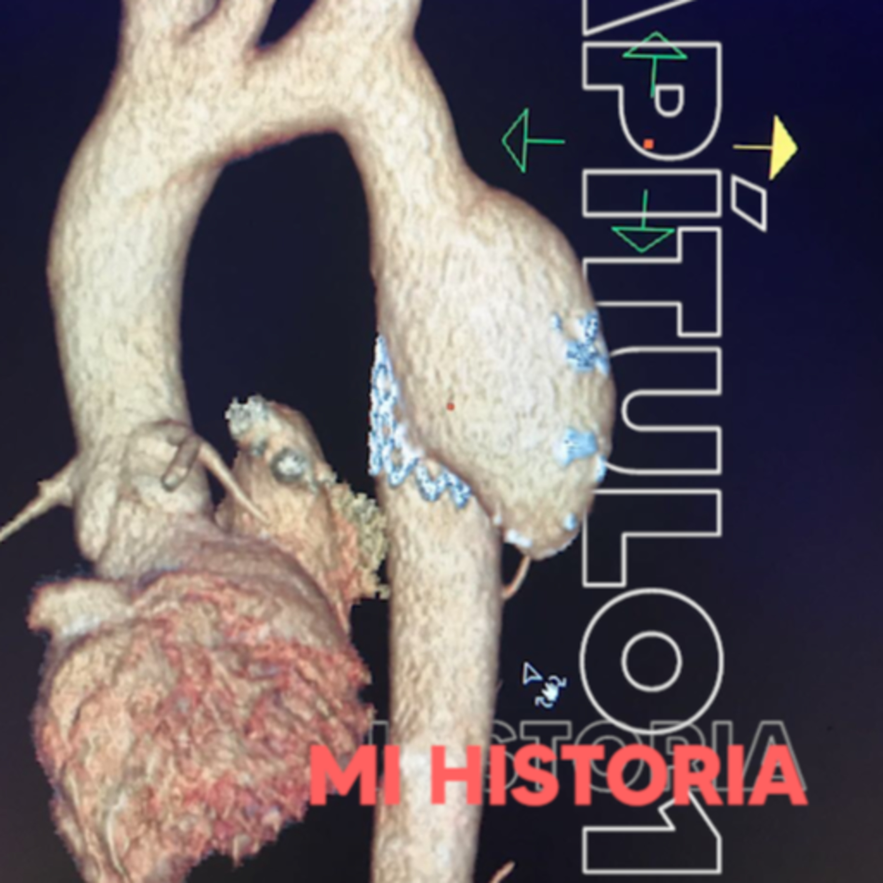 A Vuelta de Rueda.