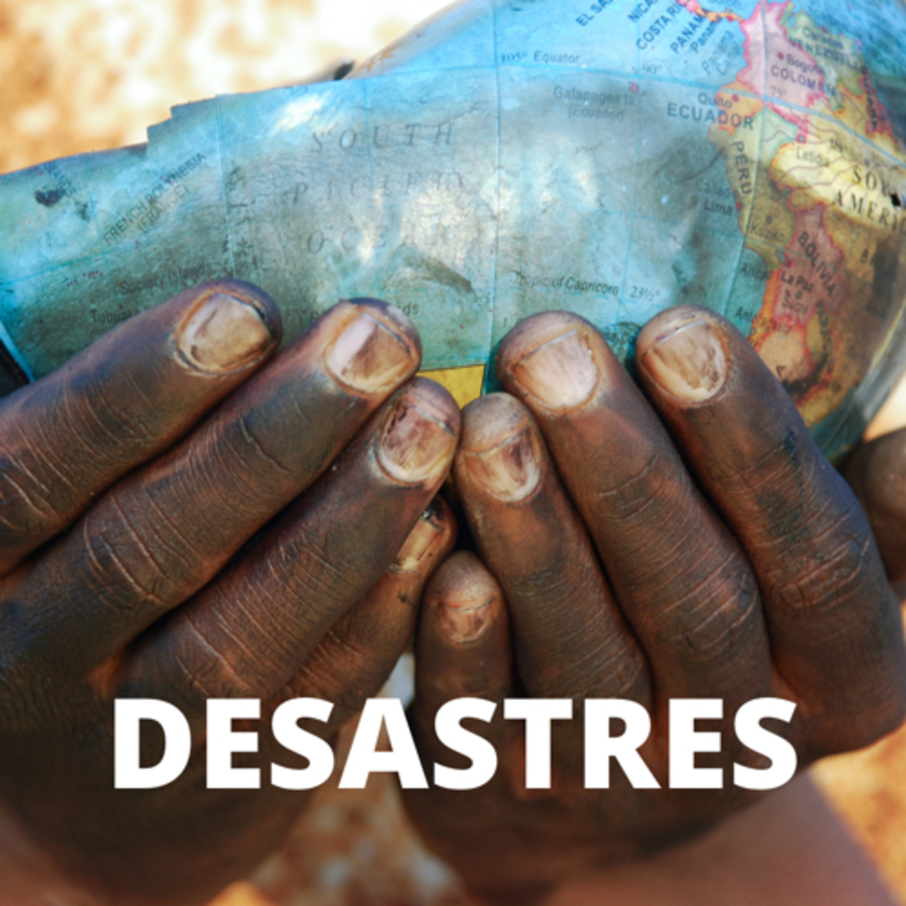 diástase
